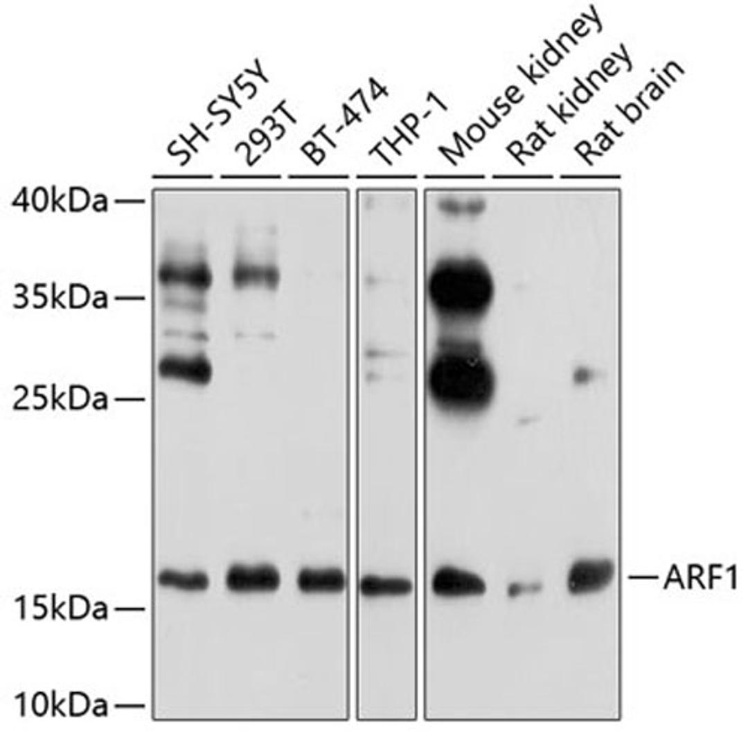 Western blot - ARF1 antibody (A7643)