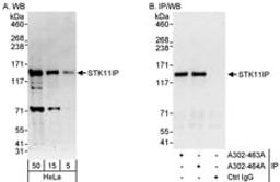 Detection of human STK11IP by western blot and immunoprecipitation.