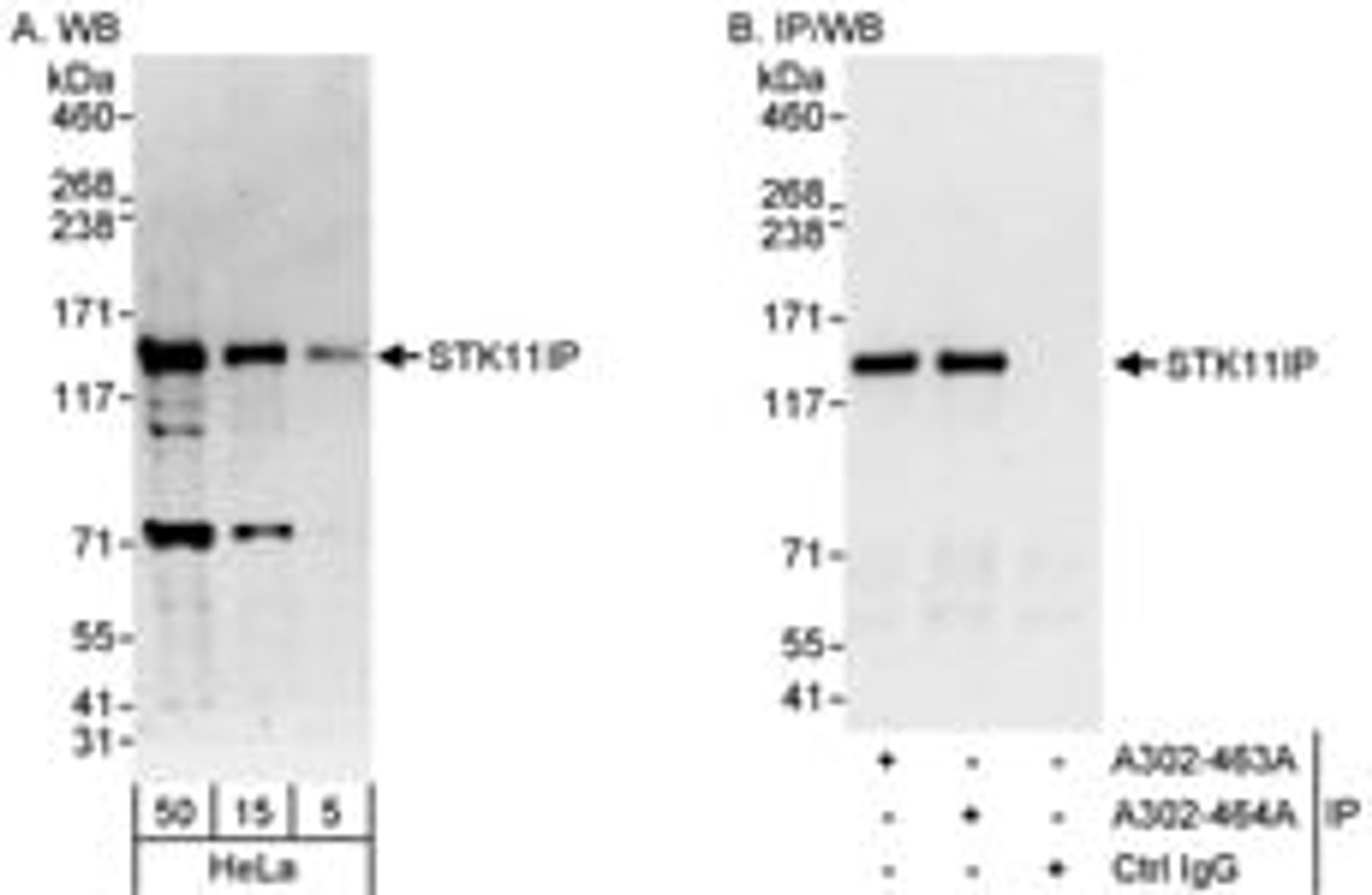 Detection of human STK11IP by western blot and immunoprecipitation.