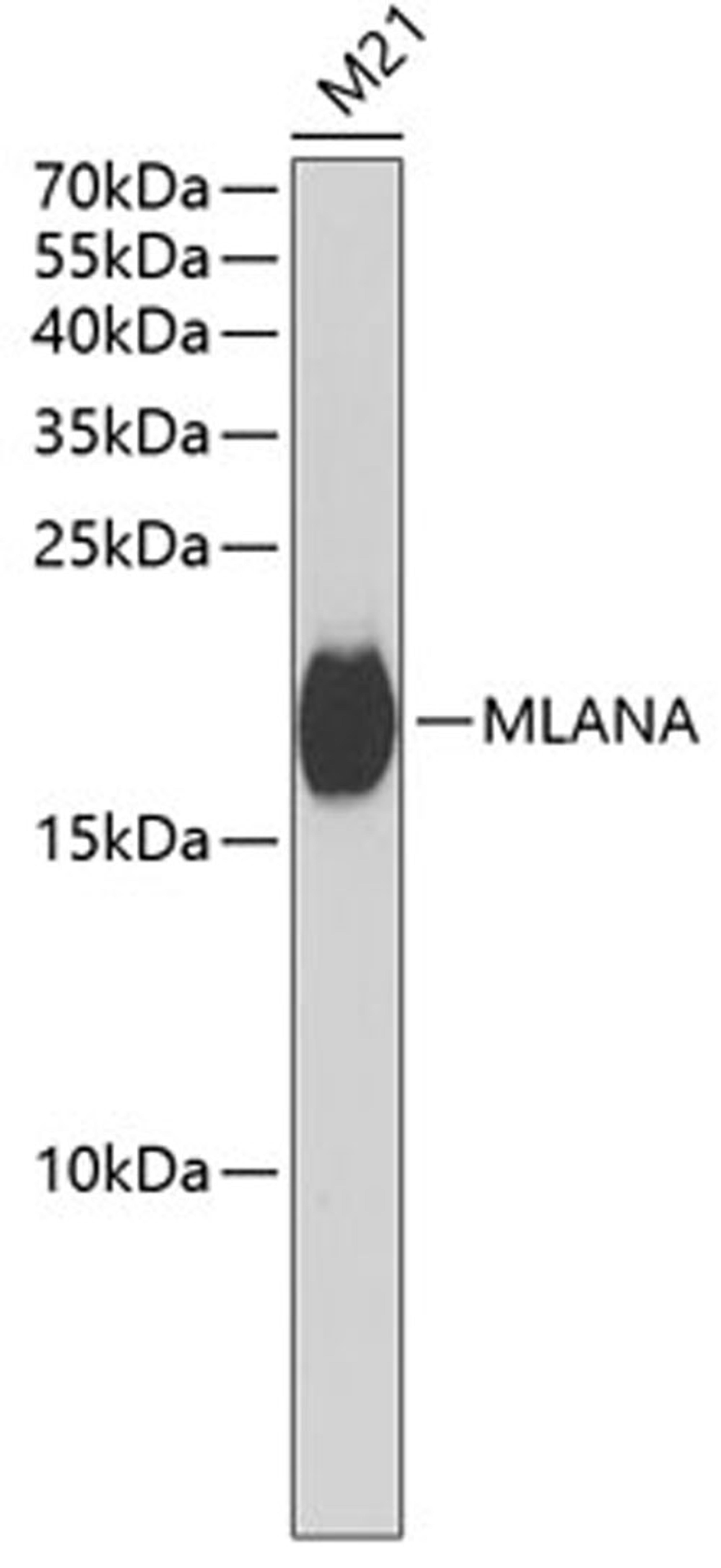 Western blot - MLANA antibody (A6290)