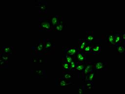 Immunofluorescence staining of Hela cells with CSB-PA017917LA01HU at 1:233, counter-stained with DAPI. The cells were fixed in 4% formaldehyde, permeabilized using 0.2% Triton X-100 and blocked in 10% normal Goat Serum. The cells were then incubated with the antibody overnight at 4&deg;C. The secondary antibody was Alexa Fluor 488-congugated AffiniPure Goat Anti-Rabbit IgG(H+L).