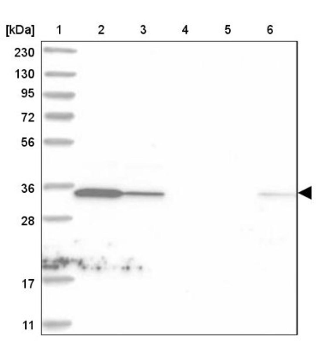 Western Blot: C1orf74 Antibody [NBP1-83571] - Lane 1: Marker [kDa] 230, 130, 95, 72, 56, 36, 28, 17, 11<br/>Lane 2: Human cell line RT-4<br/>Lane 3: Human cell line U-251MG sp<br/>Lane 4: Human plasma (IgG/HSA depleted)<br/>Lane 5: Human liver tissue<br/>Lane 6: Human tonsil tissue