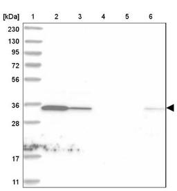 Western Blot: C1orf74 Antibody [NBP1-83571] - Lane 1: Marker [kDa] 230, 130, 95, 72, 56, 36, 28, 17, 11<br/>Lane 2: Human cell line RT-4<br/>Lane 3: Human cell line U-251MG sp<br/>Lane 4: Human plasma (IgG/HSA depleted)<br/>Lane 5: Human liver tissue<br/>Lane 6: Human tonsil tissue