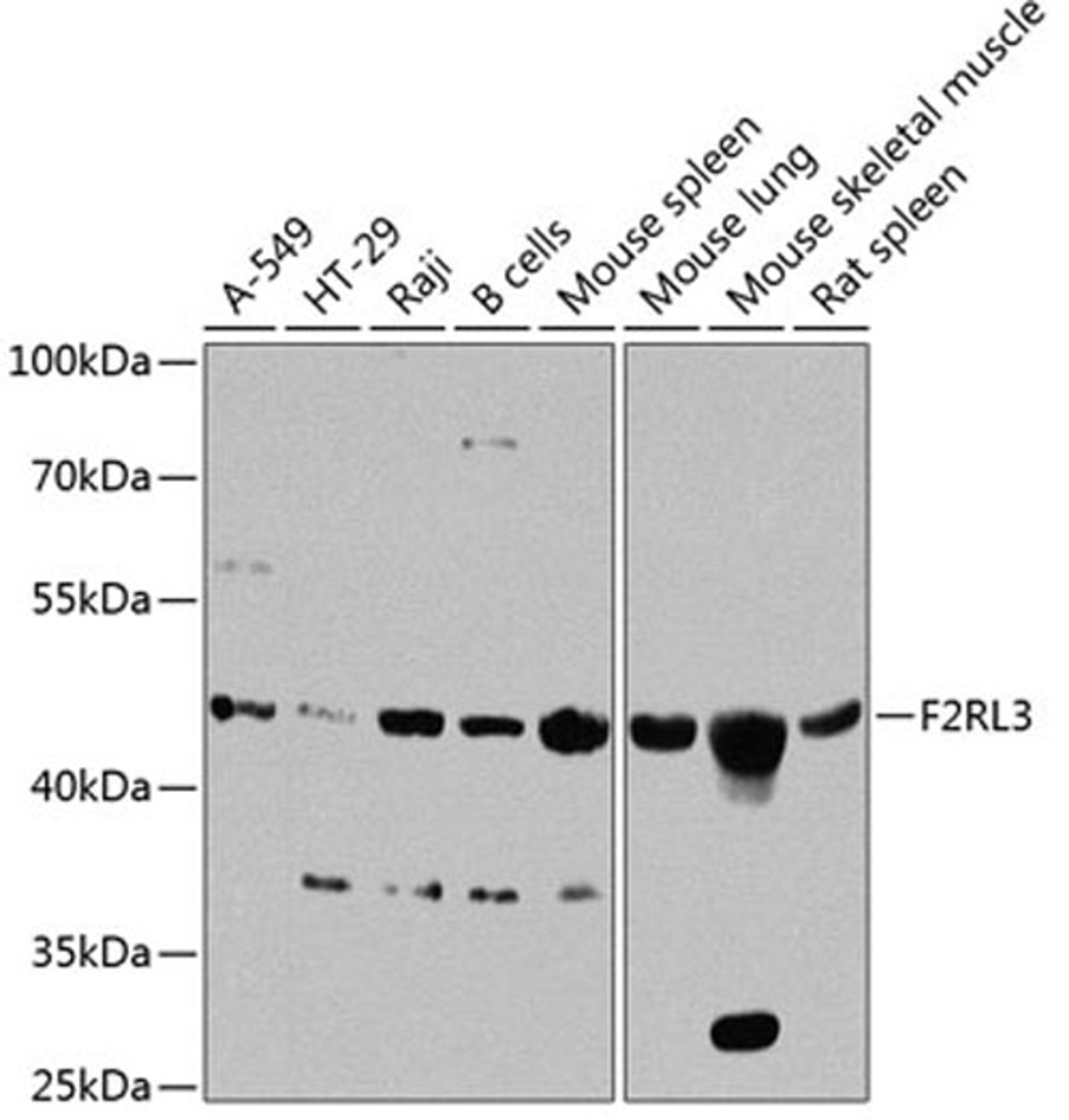 Western blot - F2RL3 antibody (A8471)