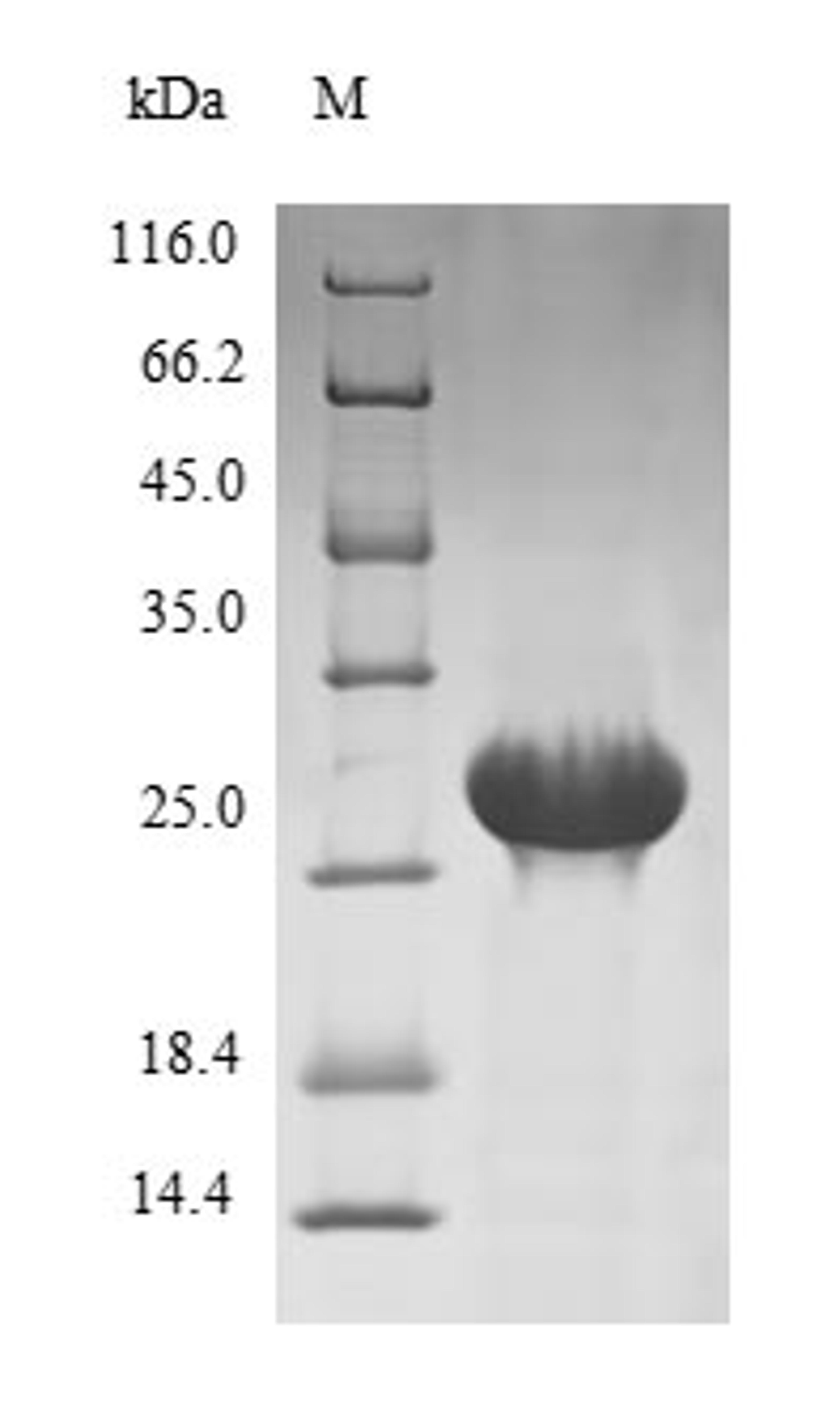 (Tris-Glycine gel) Discontinuous SDS-PAGE (reduced) with 5% enrichment gel and 15% separation gel.