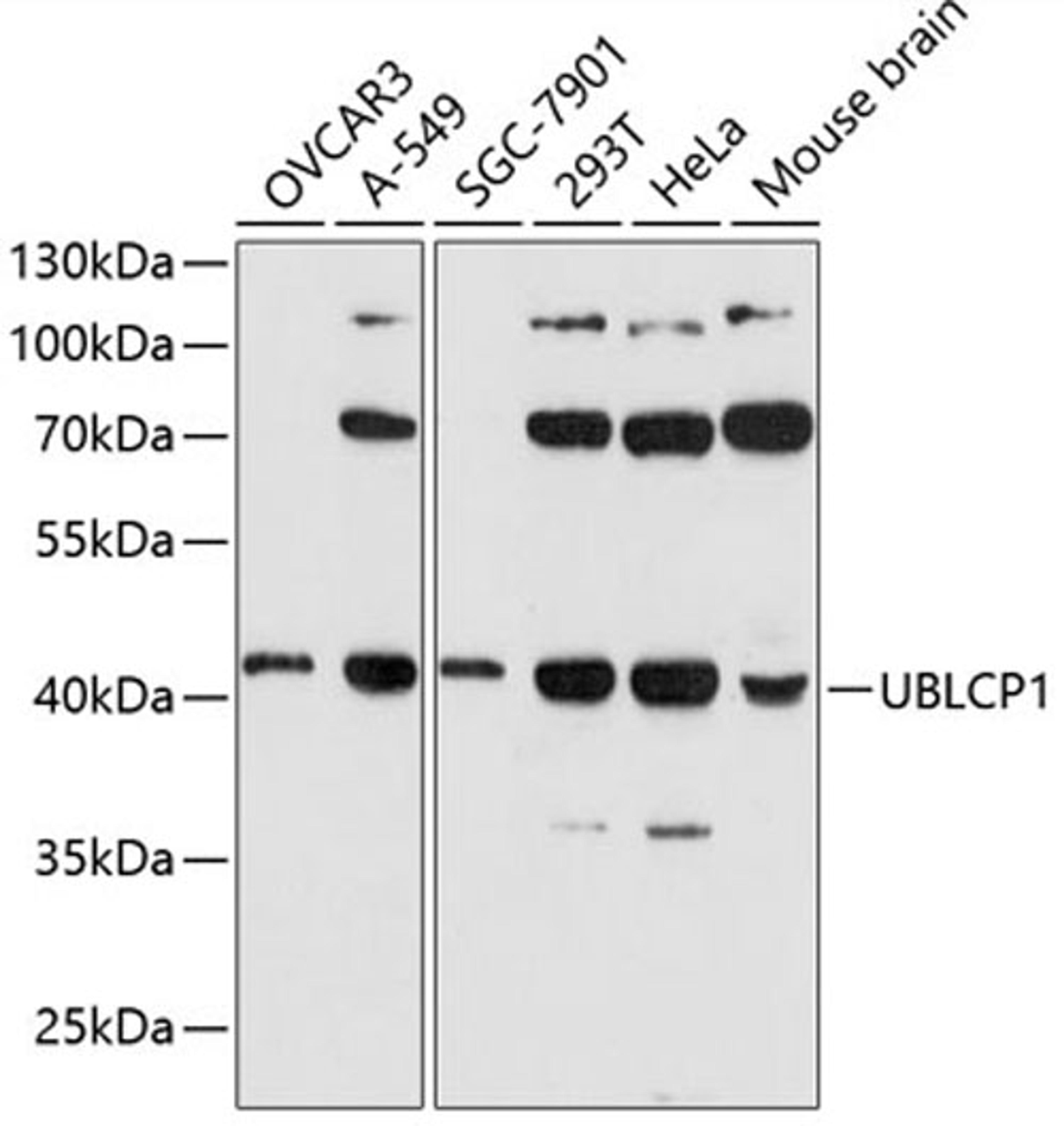 Western blot - UBLCP1 antibody (A13729)