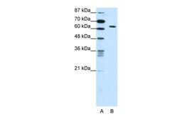 Antibody used in WB on Human Jurkat 0.625 ug/ml.