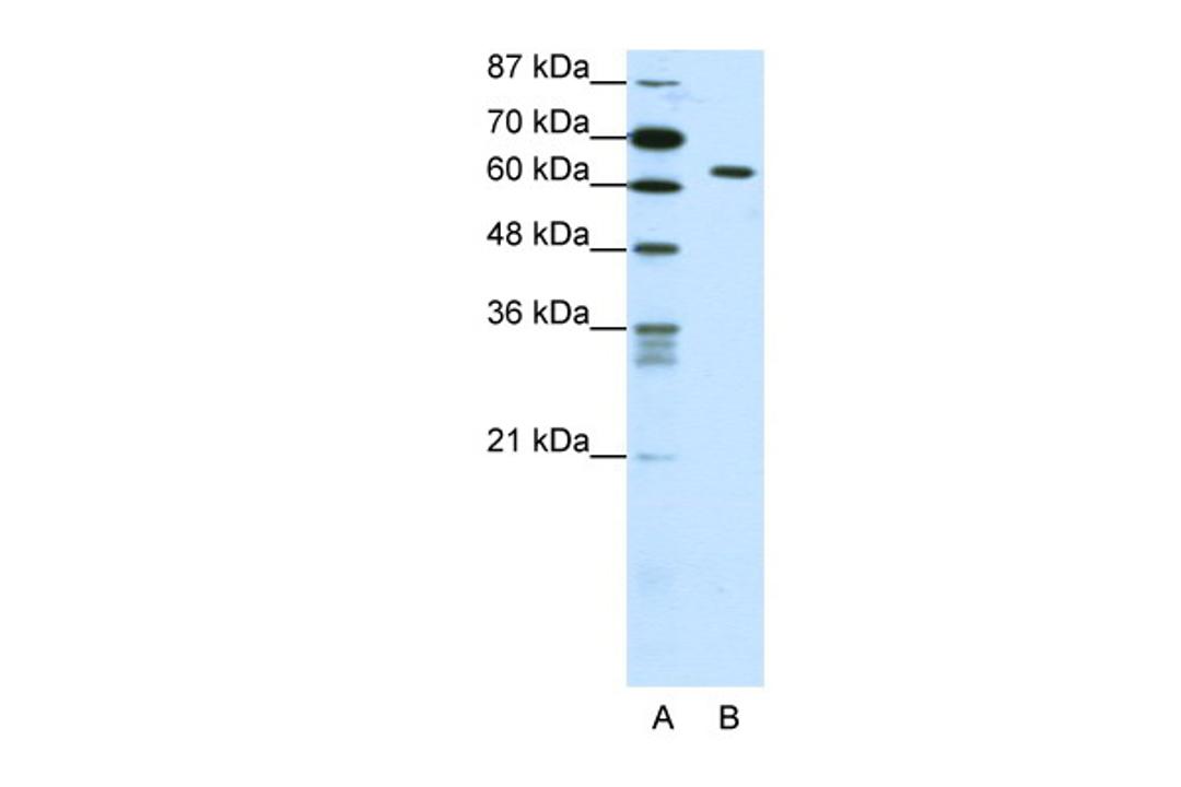 Antibody used in WB on Human Jurkat 0.625 ug/ml.