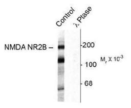 Western Blot: NMDAR2B [p Tyr1472] Antibody [NB300-182] - Western blot of rat hippocampal lysate showing specific immunolabeling of the ~180k NR2B subunit of the NMDAR phosphorylated at Tyr1472 (Control). The phosphospecificity of this labeling is shown in the second lane (lambda-phosphatase). The blot is identical to the control except that it was incubated in lambda-phosphatase (1200 units for 30 min) before being exposed to the phospho-Tyr1472 NMDA NR2B antibody. The immunolabeling is completely eliminated by treatment with lambda-phosphatase.