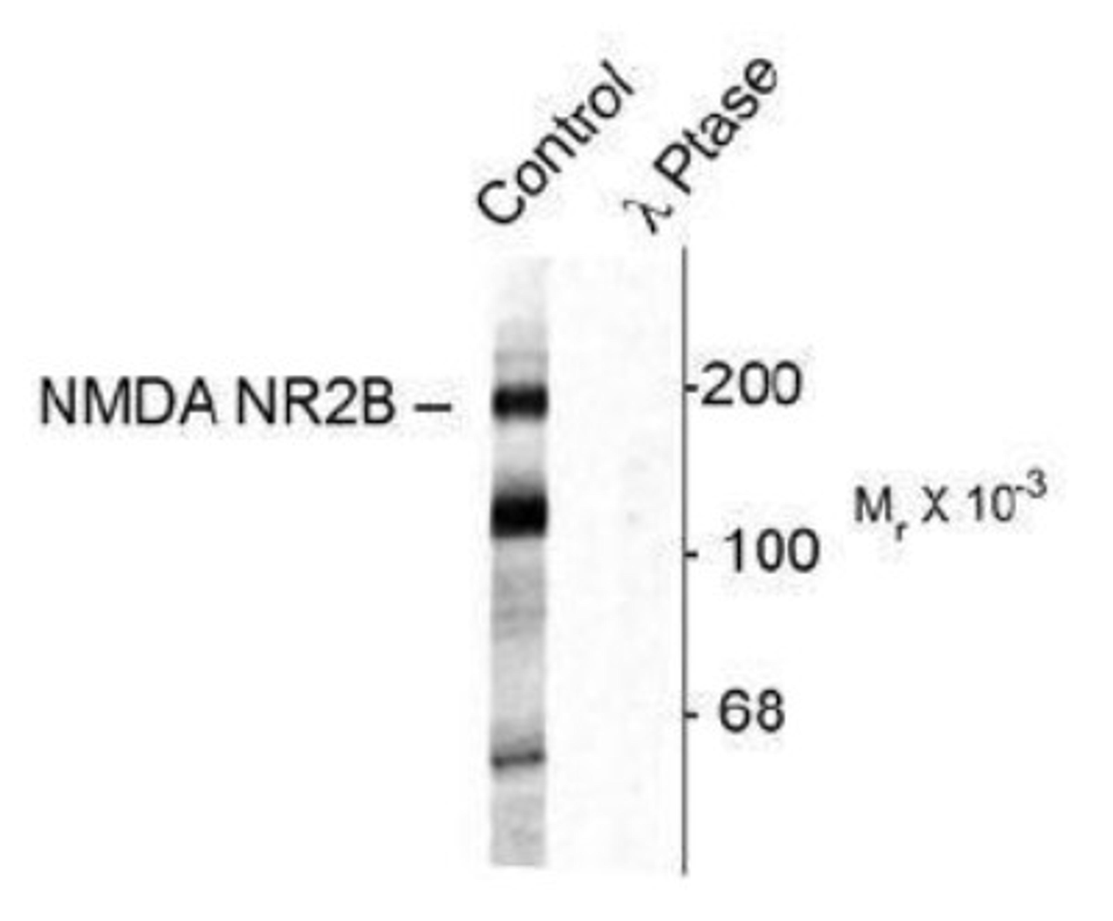 Western Blot: NMDAR2B [p Tyr1472] Antibody [NB300-182] - Western blot of rat hippocampal lysate showing specific immunolabeling of the ~180k NR2B subunit of the NMDAR phosphorylated at Tyr1472 (Control). The phosphospecificity of this labeling is shown in the second lane (lambda-phosphatase). The blot is identical to the control except that it was incubated in lambda-phosphatase (1200 units for 30 min) before being exposed to the phospho-Tyr1472 NMDA NR2B antibody. The immunolabeling is completely eliminated by treatment with lambda-phosphatase.