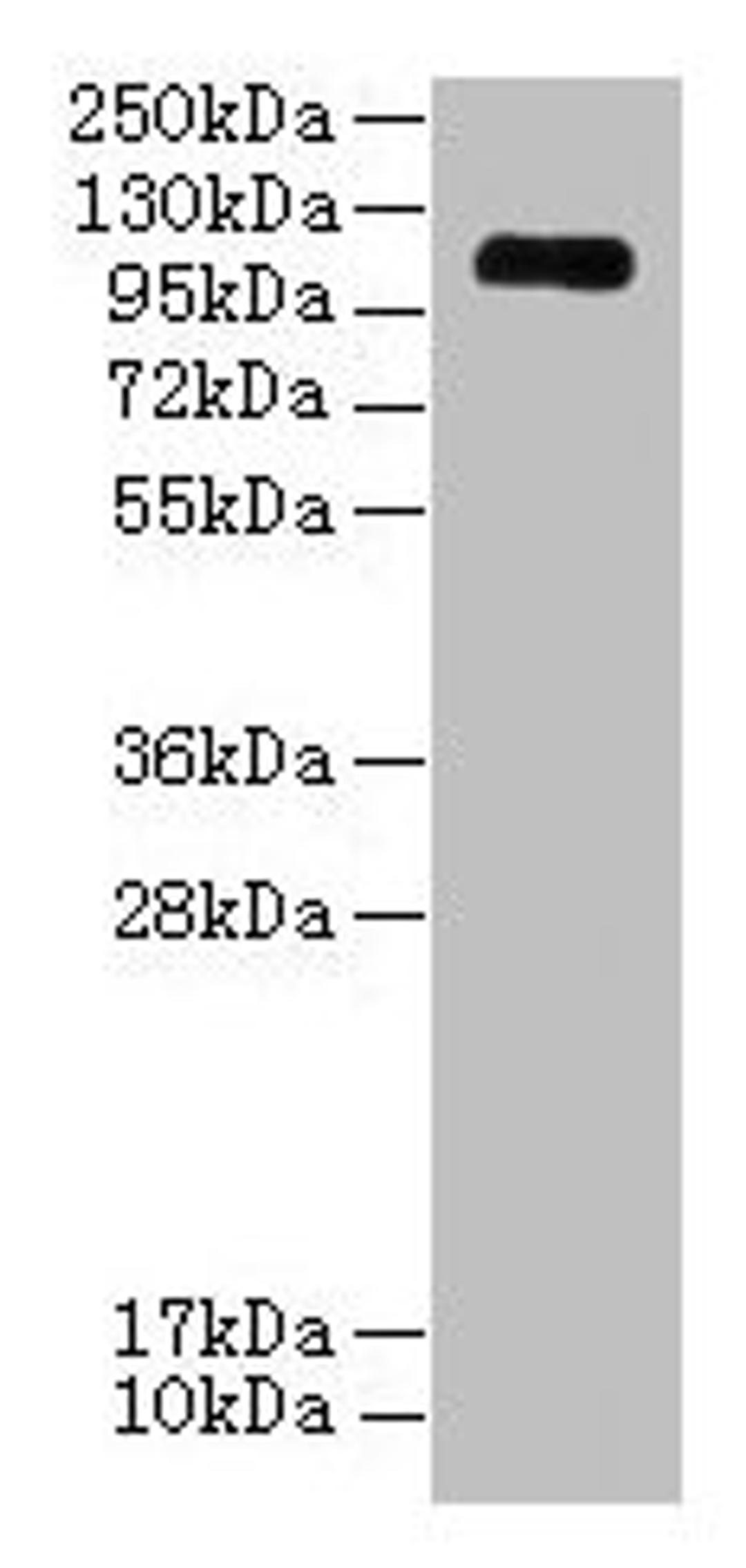 Western blot. All lanes: EGFLAM antibody at 3µg/ml + Mouse heart tissue. Secondary. Goat polyclonal to rabbit IgG at 1/10000 dilution. Predicted band size: 112, 111, 42, 85, 17 kDa. Observed band size: 112 kDa