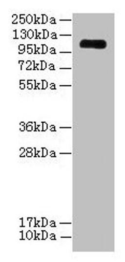 Western blot. All lanes: EGFLAM antibody at 3µg/ml + Mouse heart tissue. Secondary. Goat polyclonal to rabbit IgG at 1/10000 dilution. Predicted band size: 112, 111, 42, 85, 17 kDa. Observed band size: 112 kDa