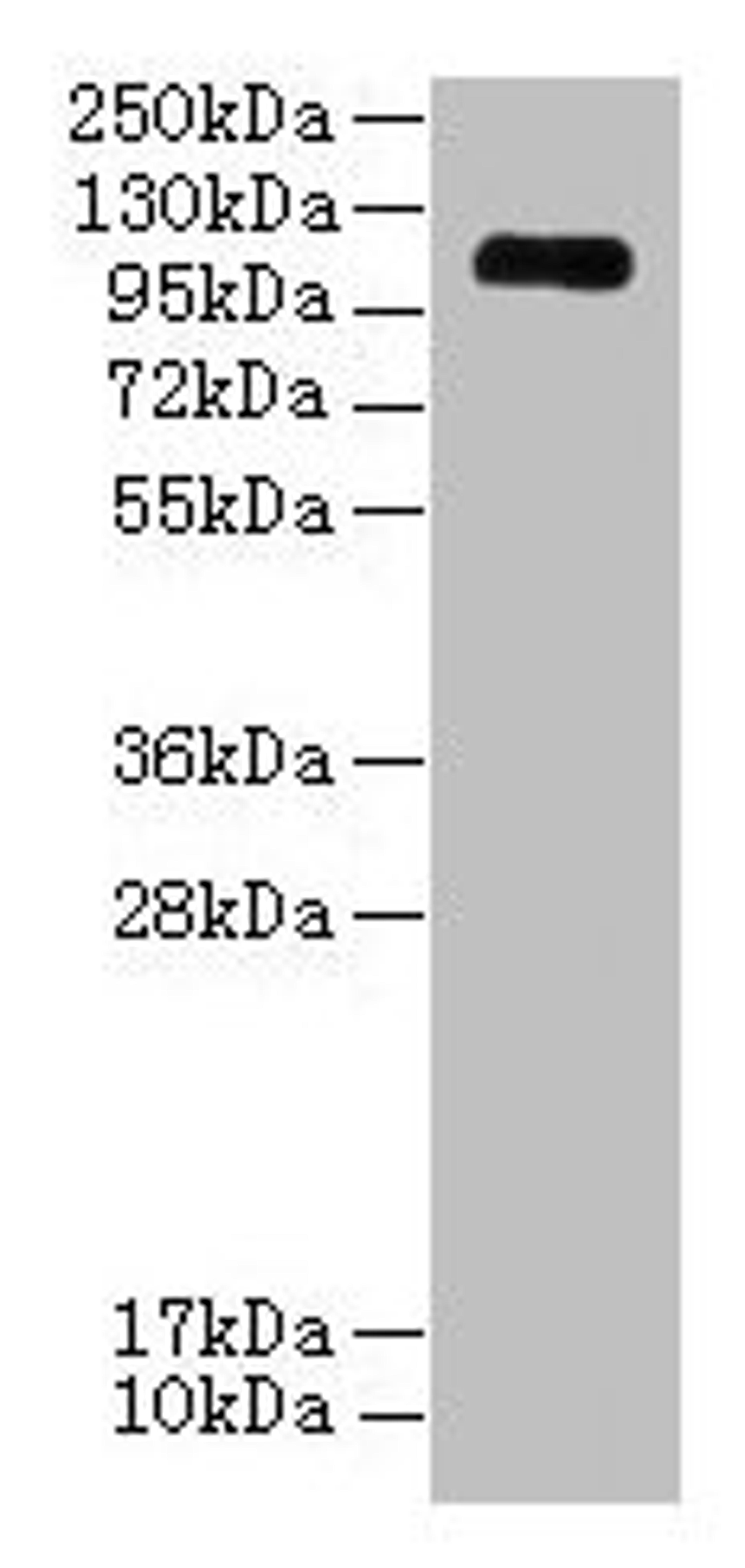 Western blot. All lanes: EGFLAM antibody at 3µg/ml + Mouse heart tissue. Secondary. Goat polyclonal to rabbit IgG at 1/10000 dilution. Predicted band size: 112, 111, 42, 85, 17 kDa. Observed band size: 112 kDa