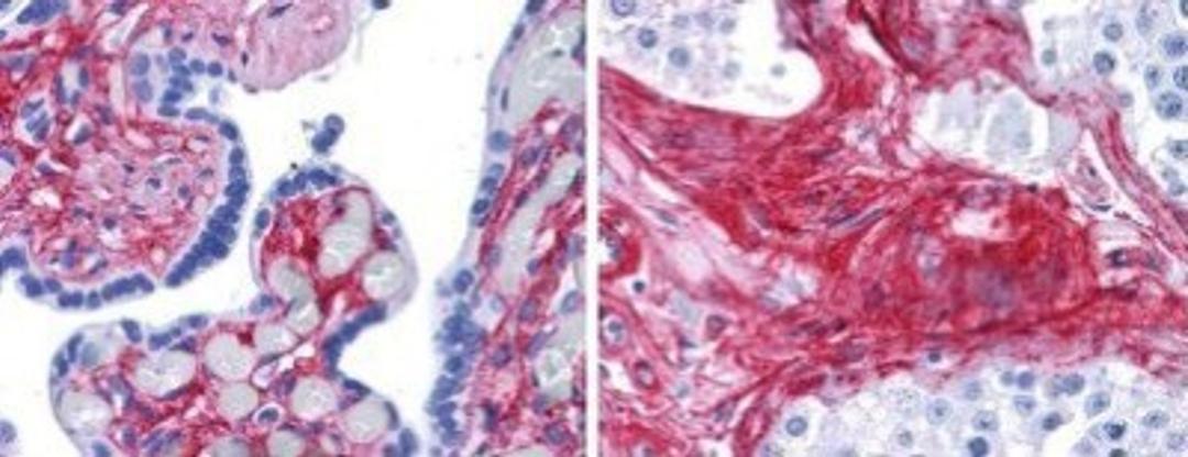 Immunohistochemistry-Paraffin: Collagen VI Antibody [NB120-6588] - Analysis using the Biotin conjugate of NB120-6588. collagen VI antibody 1:400 45 min RT showed strong staining in FFPE sections of human placenta (Left) with red staining of stromal and extracellular spaces, and in testis (Right) with staining of extracellular spaces between seminiferous tubules). Slides were steamed in 0.01 M sodium citrate buffer, pH 6.0 at 99-100C - 20 minutes for antigen retrieval.