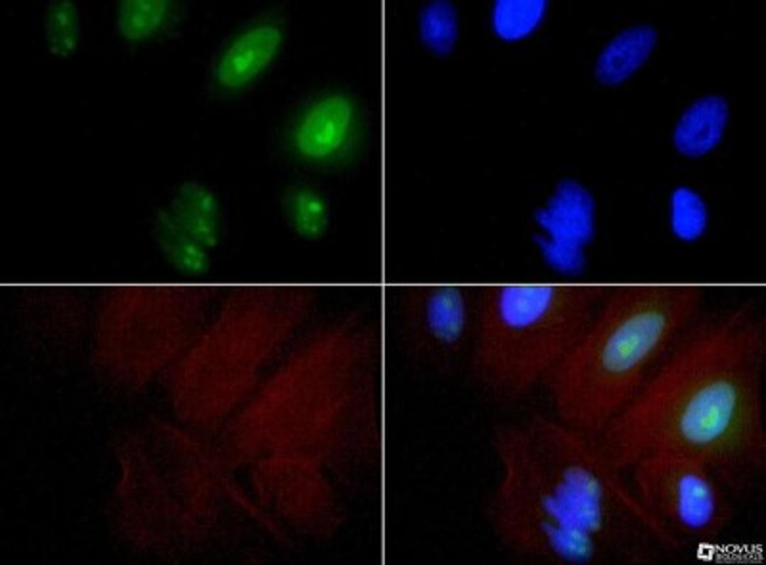 Immunocytochemistry/Immunofluorescence: Exosome Component 9 Antibody [NBP1-71702] - EXOSC9 antibody was tested at 1:100 in HeLa cells with FITC (green). Nuclei and actin were counterstained with Dapi (blue) and Phalloidin (red).