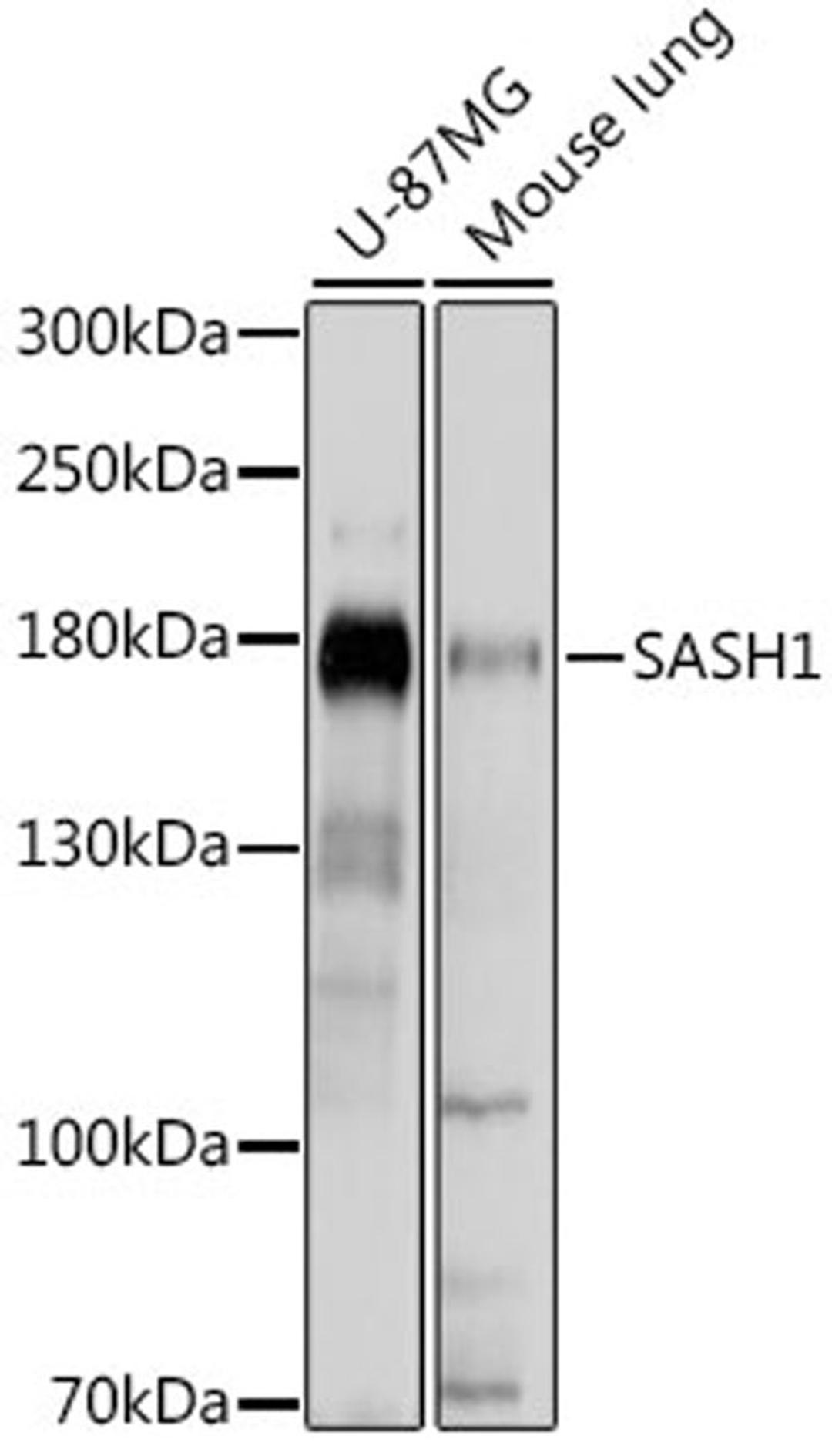 Western blot - SASH1 antibody (A15248)