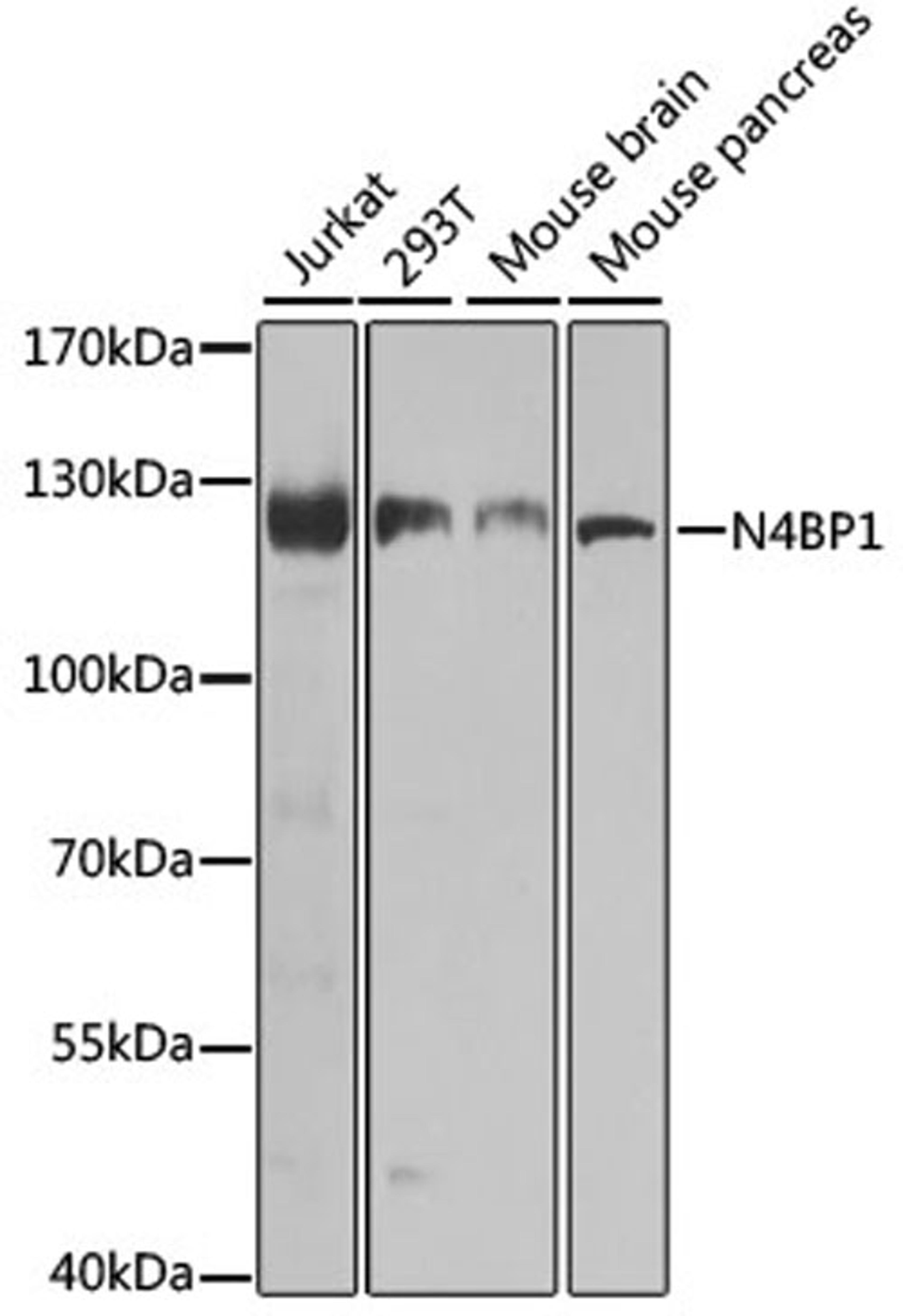 Western blot - N4BP1 antibody (A8474)