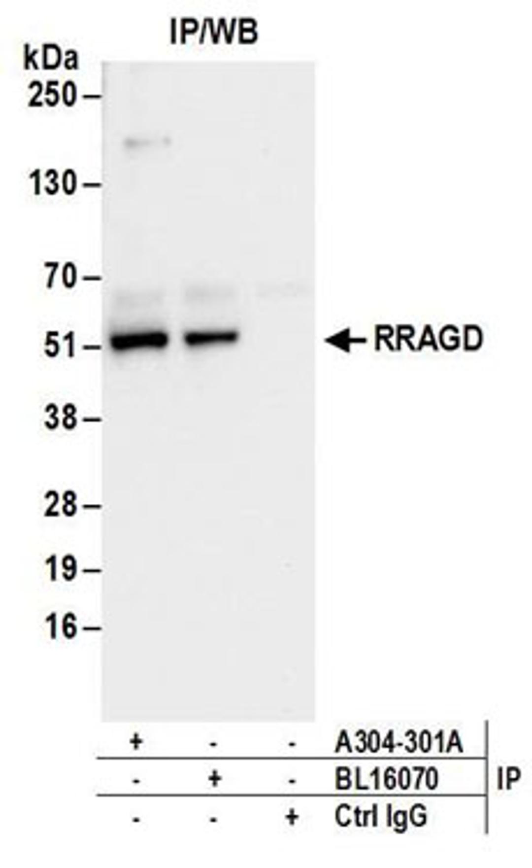 Detection of human RRAGD by western blot of immunoprecipitates.