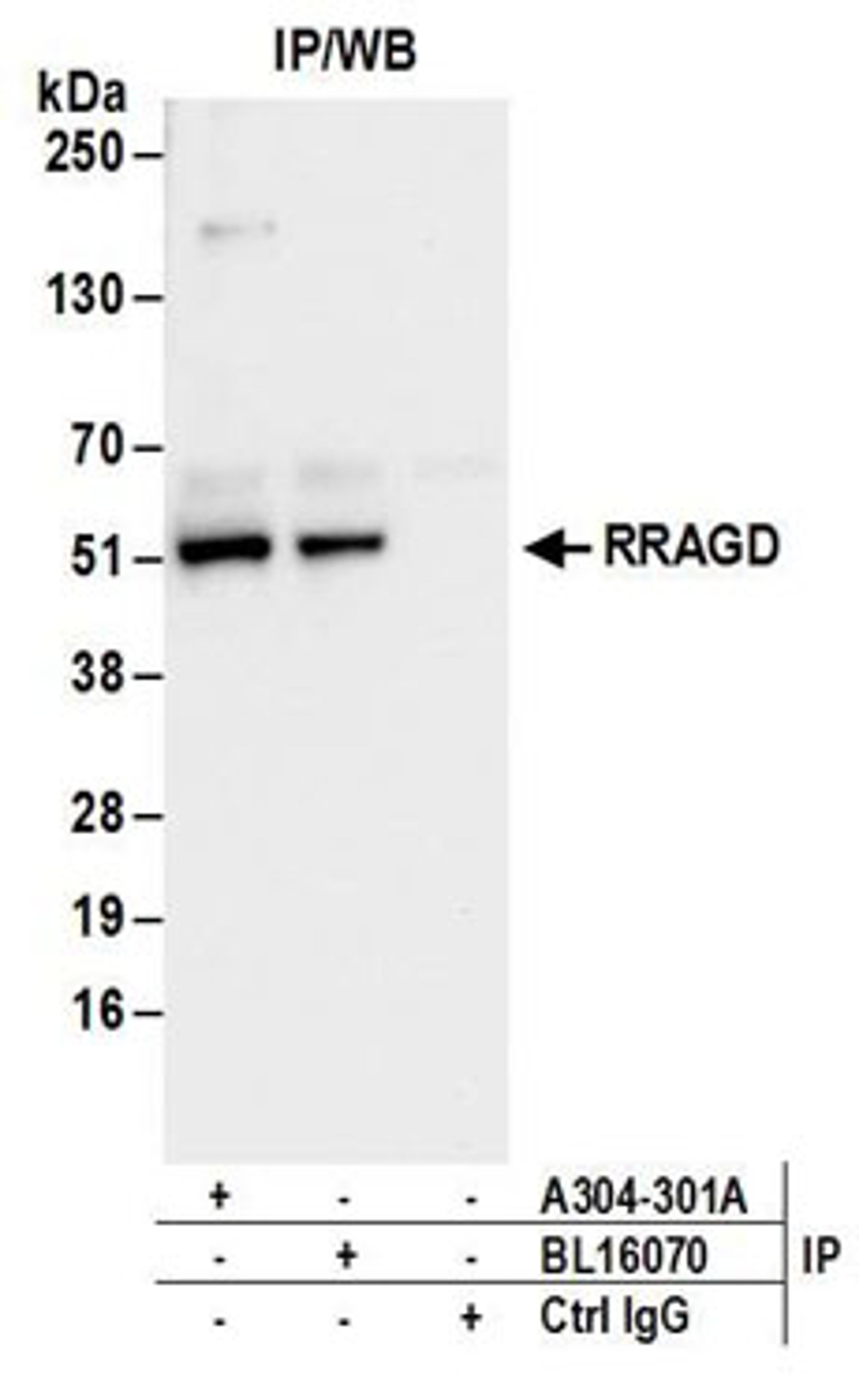 Detection of human RRAGD by western blot of immunoprecipitates.