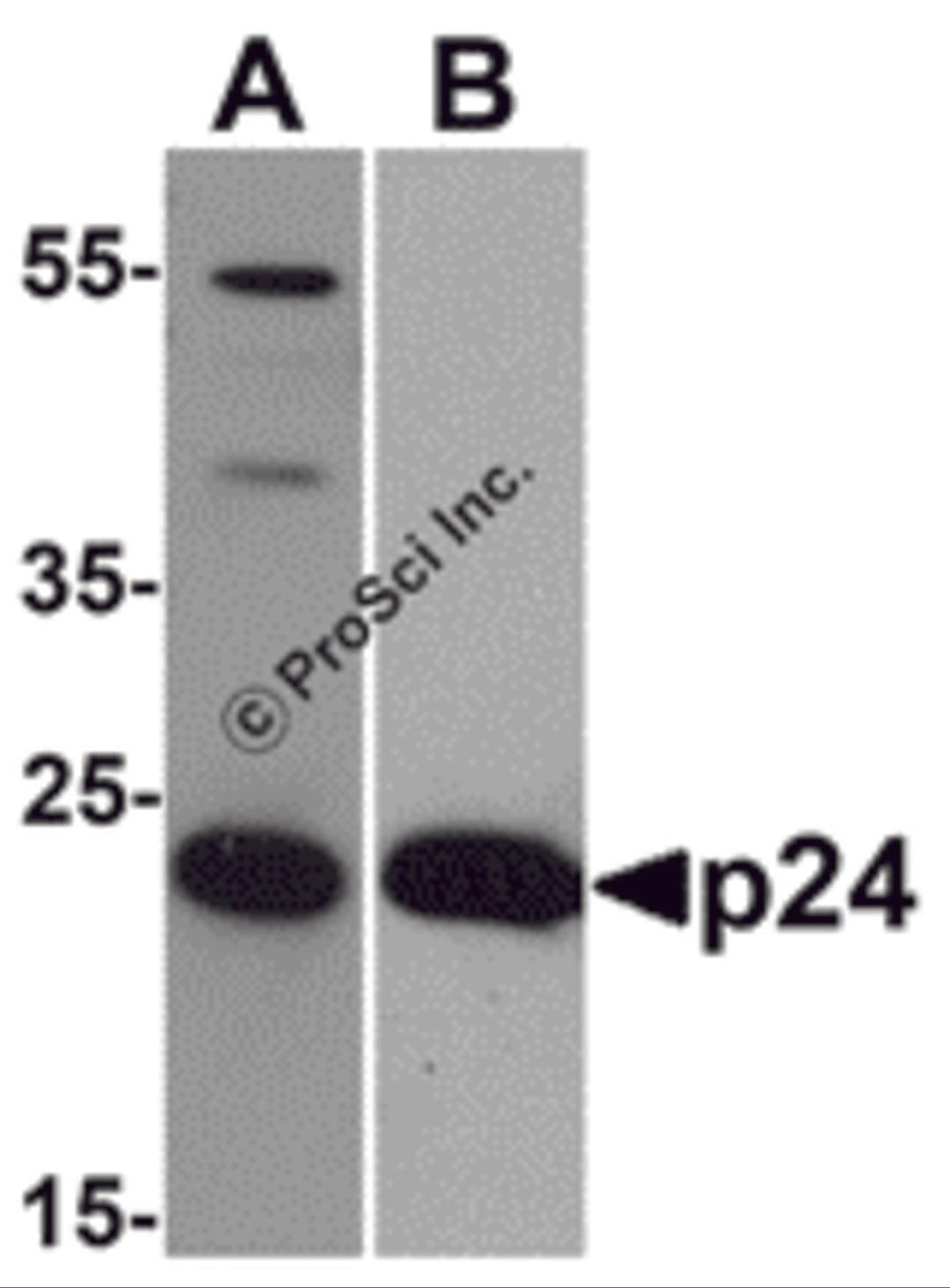 Western blot analysis of 20 ng of (A) viral p24 and (B) recombinant p24 with anti-HIV-1 p24 antibody PM-6335 at (A) 0.5 &#956;g/mL and (B) 0.2 &#956;g/mL, respectively.