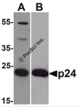 Western blot analysis of 20 ng of (A) viral p24 and (B) recombinant p24 with anti-HIV-1 p24 antibody PM-6335 at (A) 0.5 μg/mL and (B) 0.2 μg/mL, respectively.