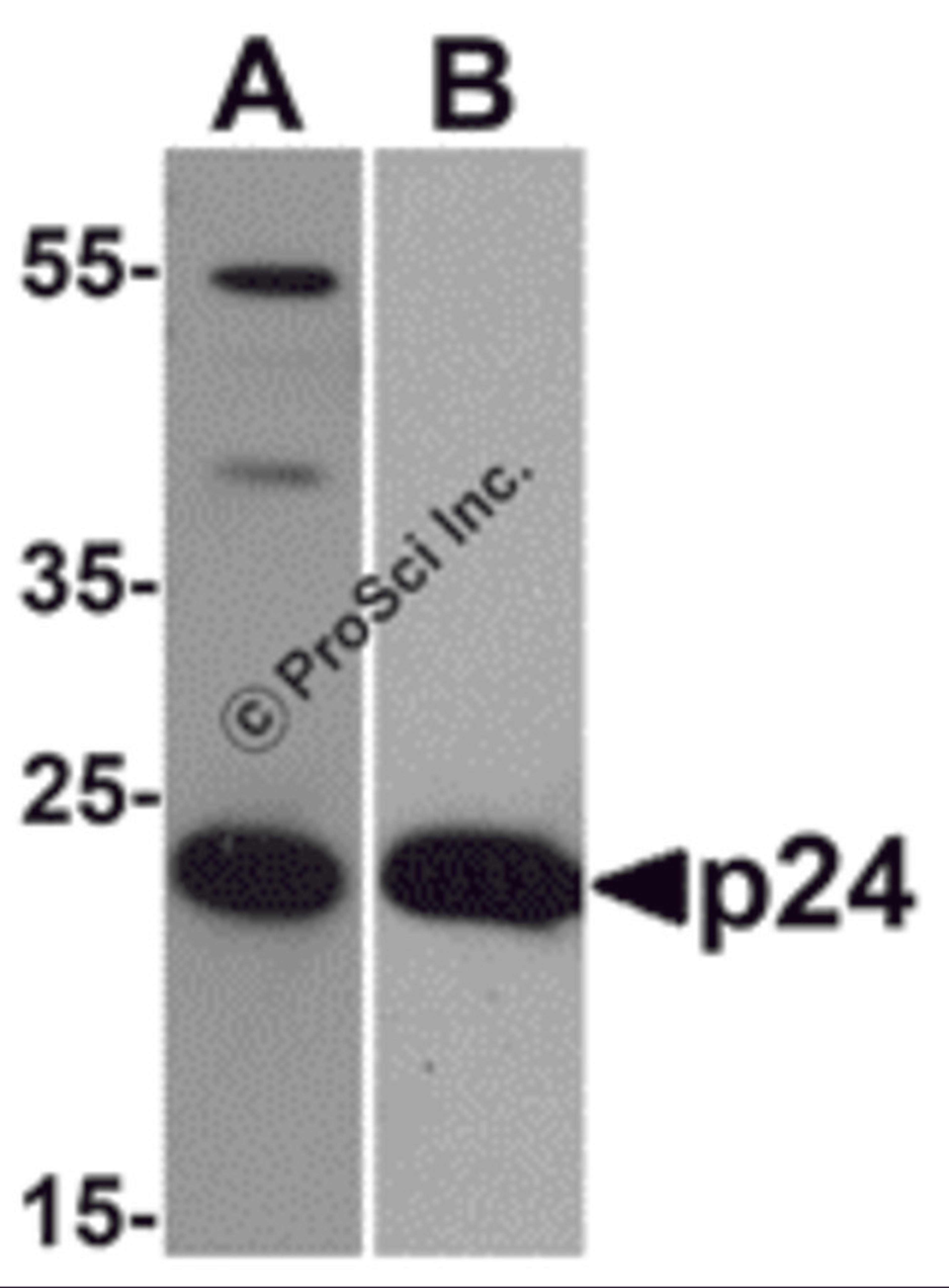 Western blot analysis of 20 ng of (A) viral p24 and (B) recombinant p24 with anti-HIV-1 p24 antibody PM-6335 at (A) 0.5 μg/mL and (B) 0.2 μg/mL, respectively.