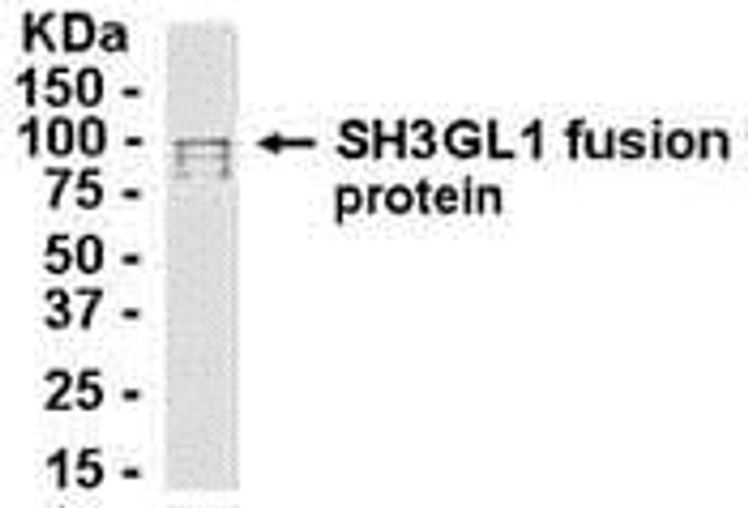 E coli-derived fusion protein as test antigen. Affinity-purified IgY dilution: 1:2000, Goat anti-IgY-HRP dilution: 1:1000. Colorimetric method for signal development.