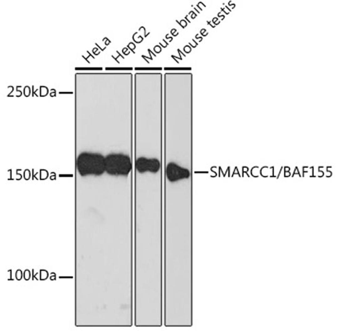 Western blot - SMARCC1/BAF155 Rabbit mAb (A4275)