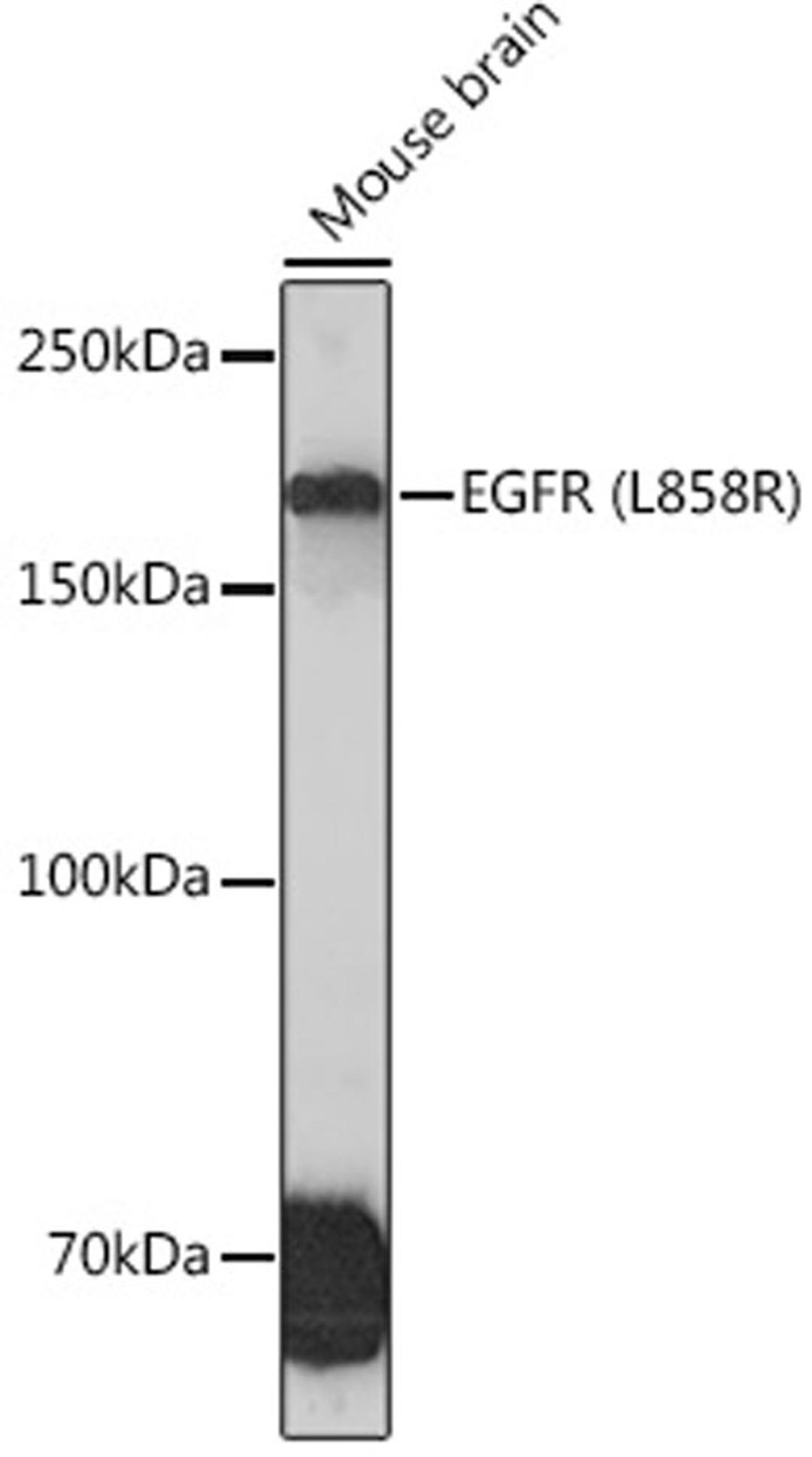 Western blot - EGFR (L858R) Rabbit mAb (A5031)