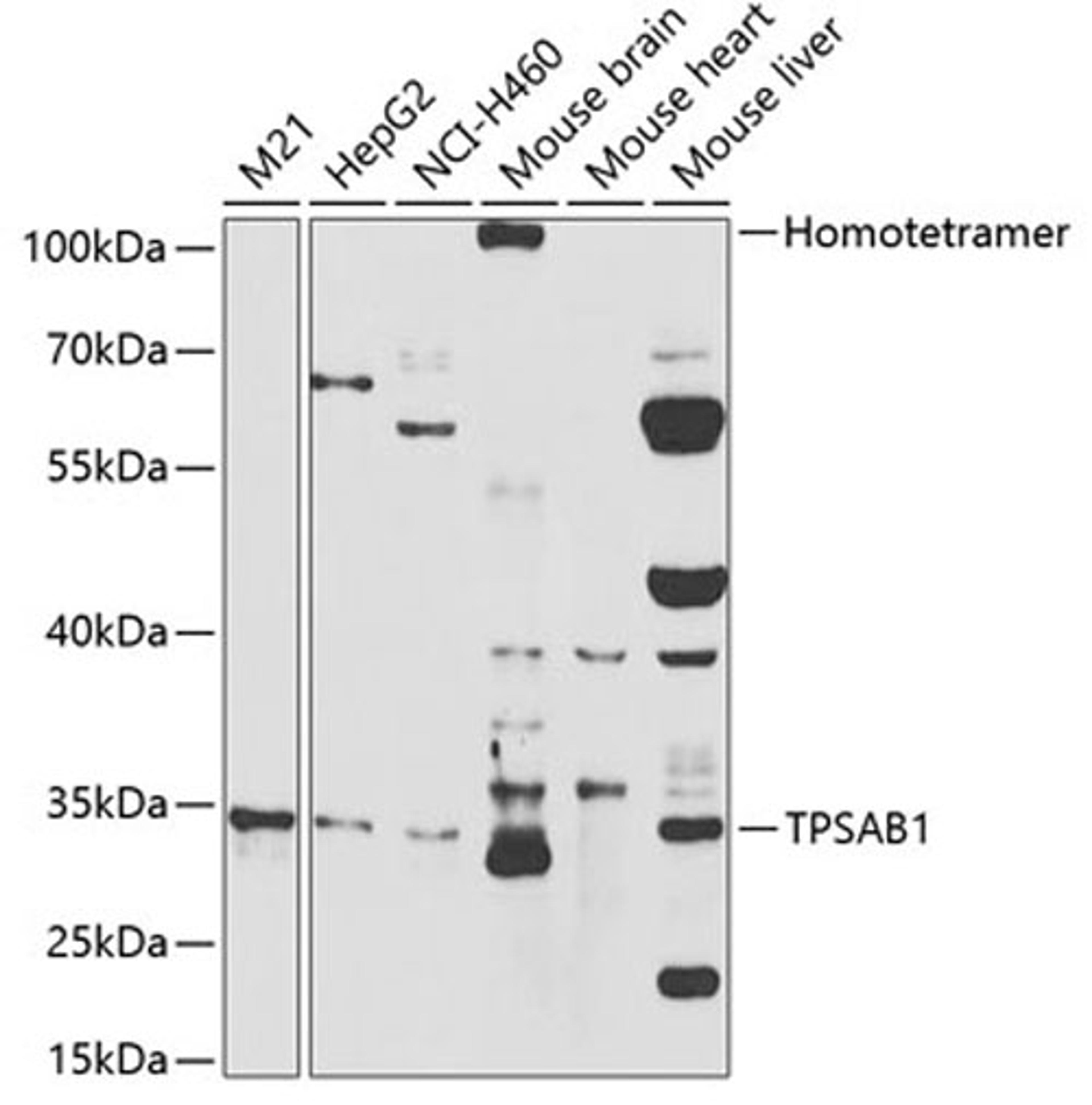 Western blot - TPSAB1 antibody (A2022)