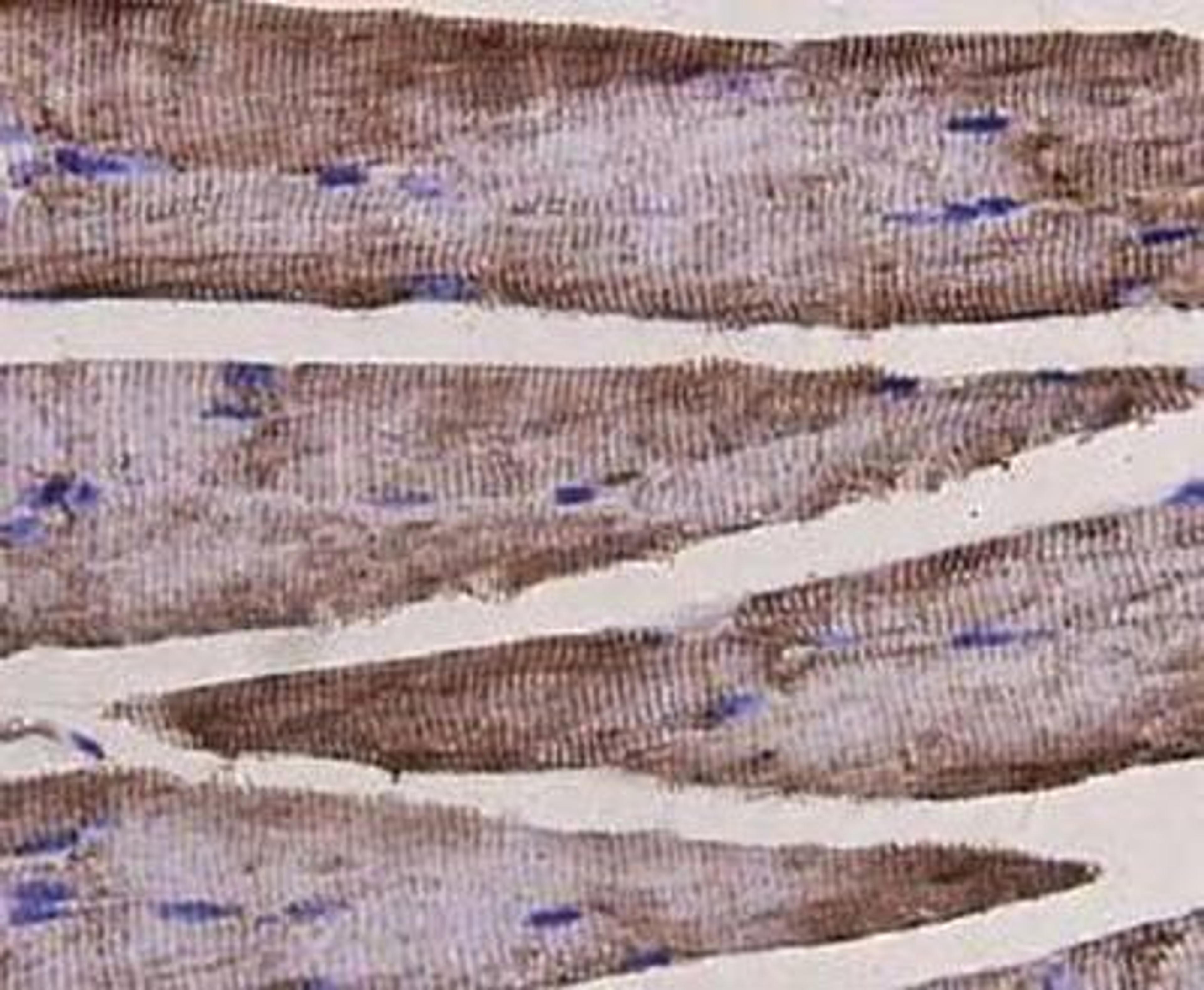 Immunohistochemical staining of mouse heart tissue using Desmin antibody