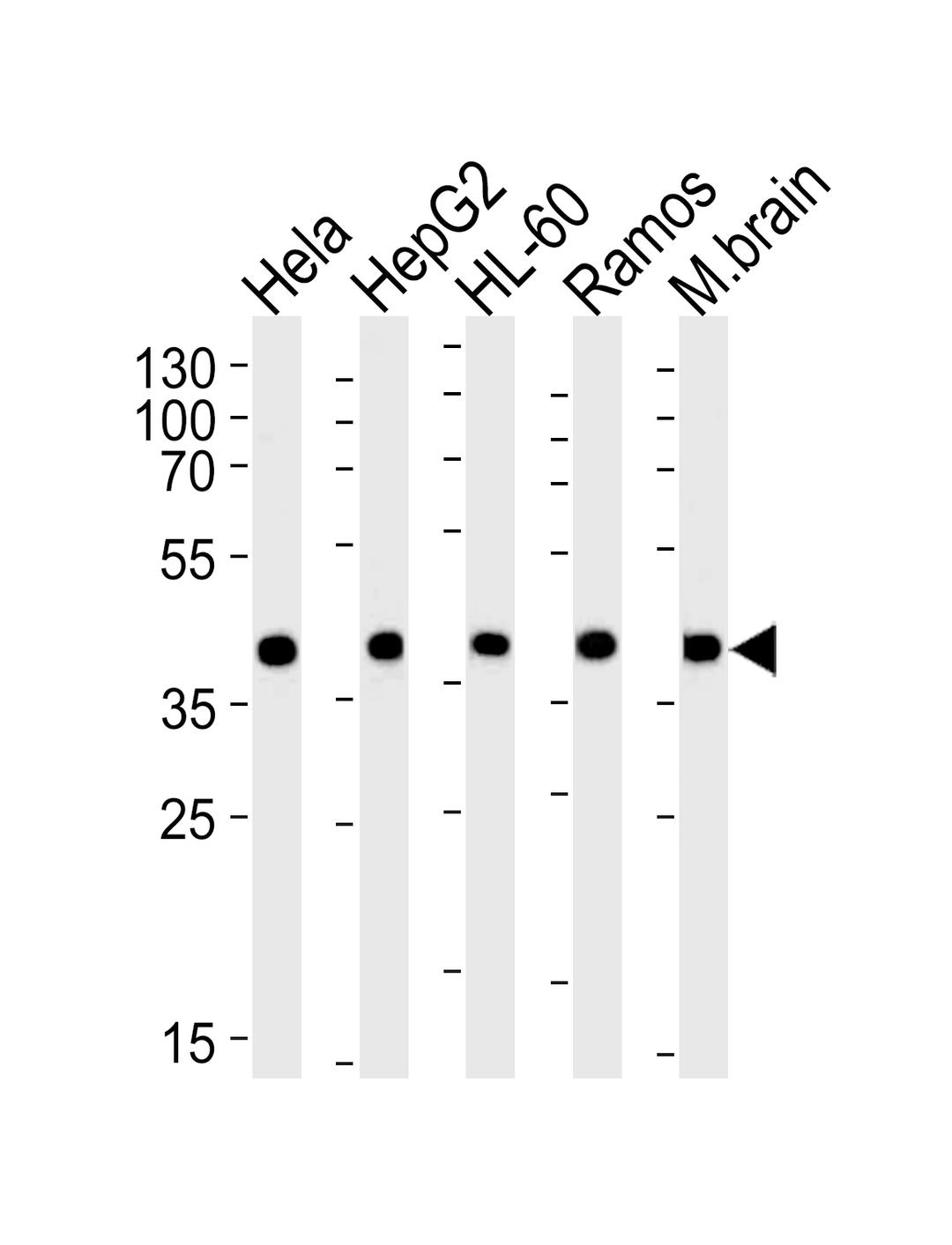 Western blot analysis of lysates from Hela, HepG2, HL-60, Ramos, mouse brain cell line (from left to right), using GOT2 Antibody at 1:1000 at each lane.