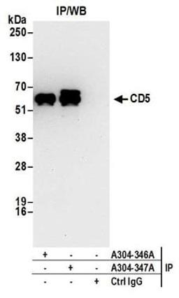 Detection of human CD5 by western blot of immunoprecipitates.