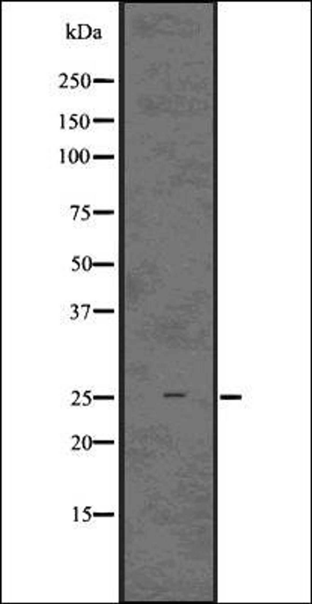 Western blot analysis of HeLa whole cell lysates using IBA1 antibody