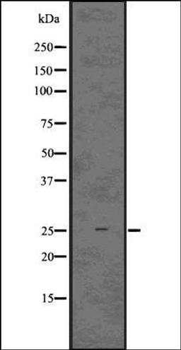 Western blot analysis of HeLa whole cell lysates using IBA1 antibody