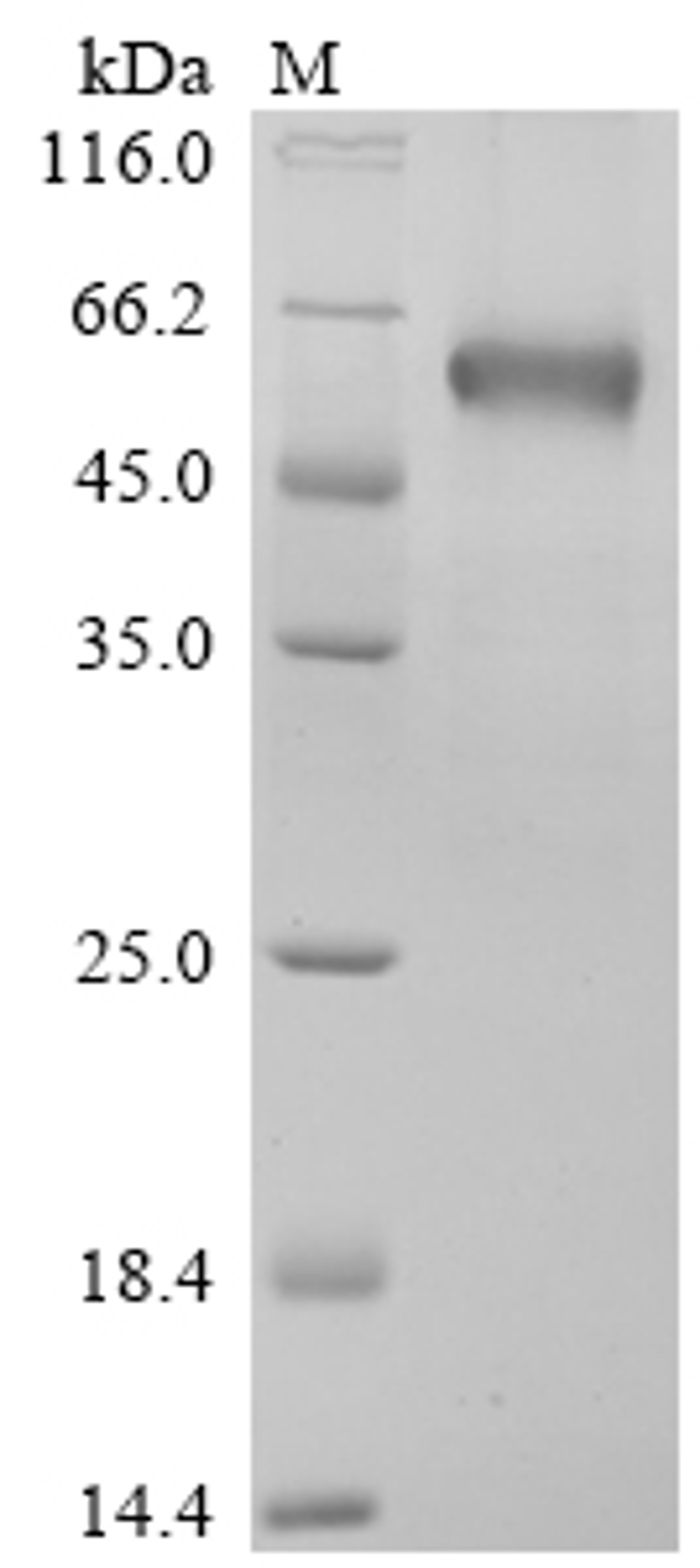 (Tris-Glycine gel) Discontinuous SDS-PAGE (reduced) with 5% enrichment gel and 15% separation gel.