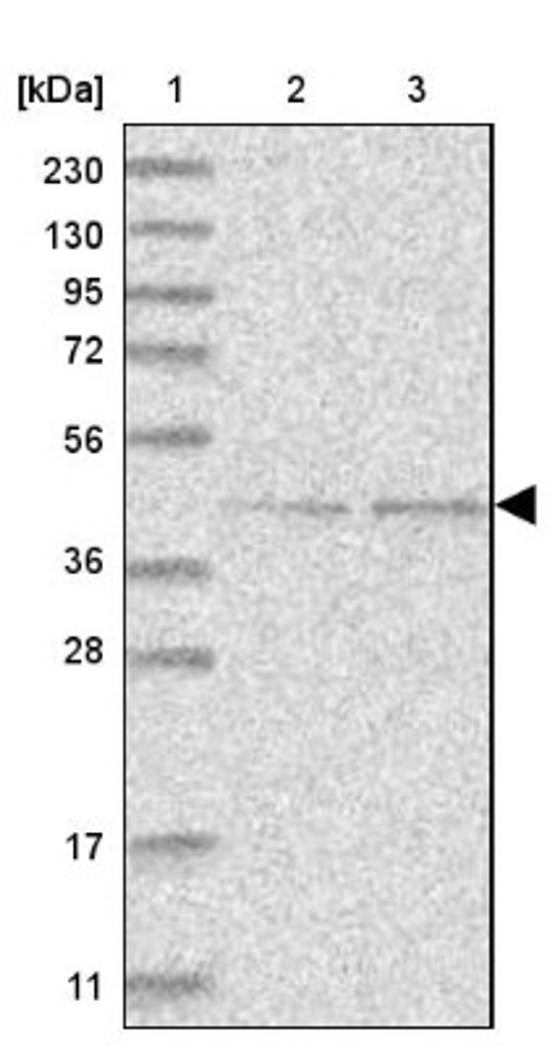 Western Blot: GTDC1 Antibody [NBP1-83725] - Lane 1: Marker [kDa] 230, 130, 95, 72, 56, 36, 28, 17, 11<br/>Lane 2: Human cell line RT-4<br/>Lane 3: Human cell line U-251MG sp