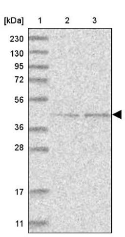 Western Blot: GTDC1 Antibody [NBP1-83725] - Lane 1: Marker [kDa] 230, 130, 95, 72, 56, 36, 28, 17, 11<br/>Lane 2: Human cell line RT-4<br/>Lane 3: Human cell line U-251MG sp