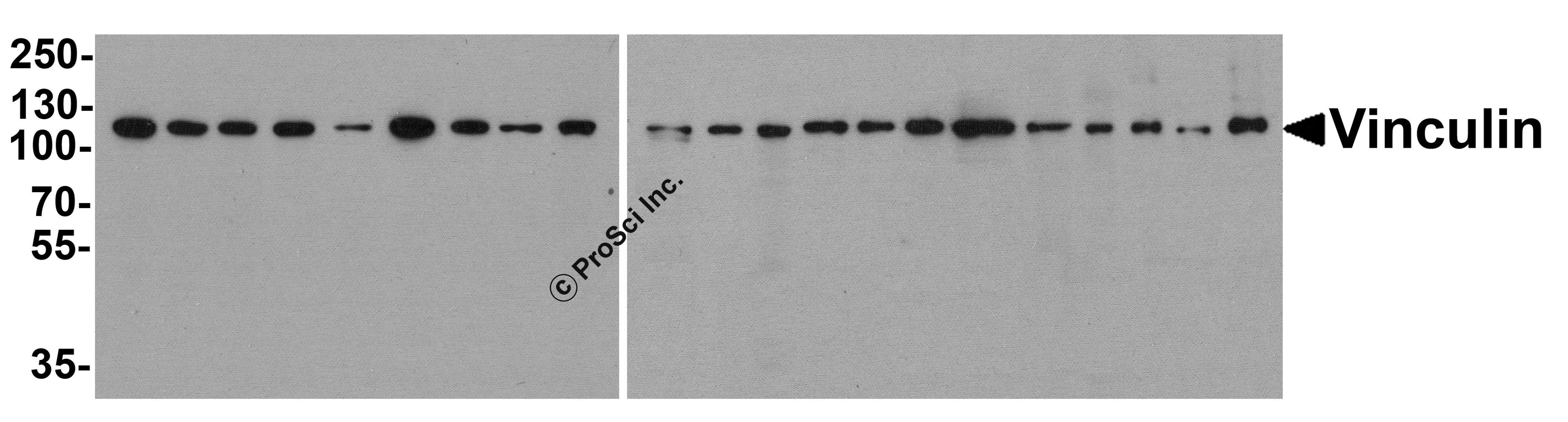 Western blot analysis of Vinculin in 293, A431, A549, HeLa, HepG2, K562, 3T3, Raji, U937 cell lysate and human kidney, human breast, mouse brain, mouse lung, mouse spleen, rat heart, rat lung, rat spleen, rat liver, rabbit spleen, rabbit brain and chicken