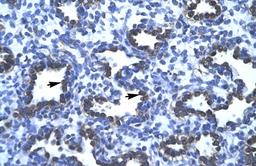 Antibody used in IHC on Human Lung.