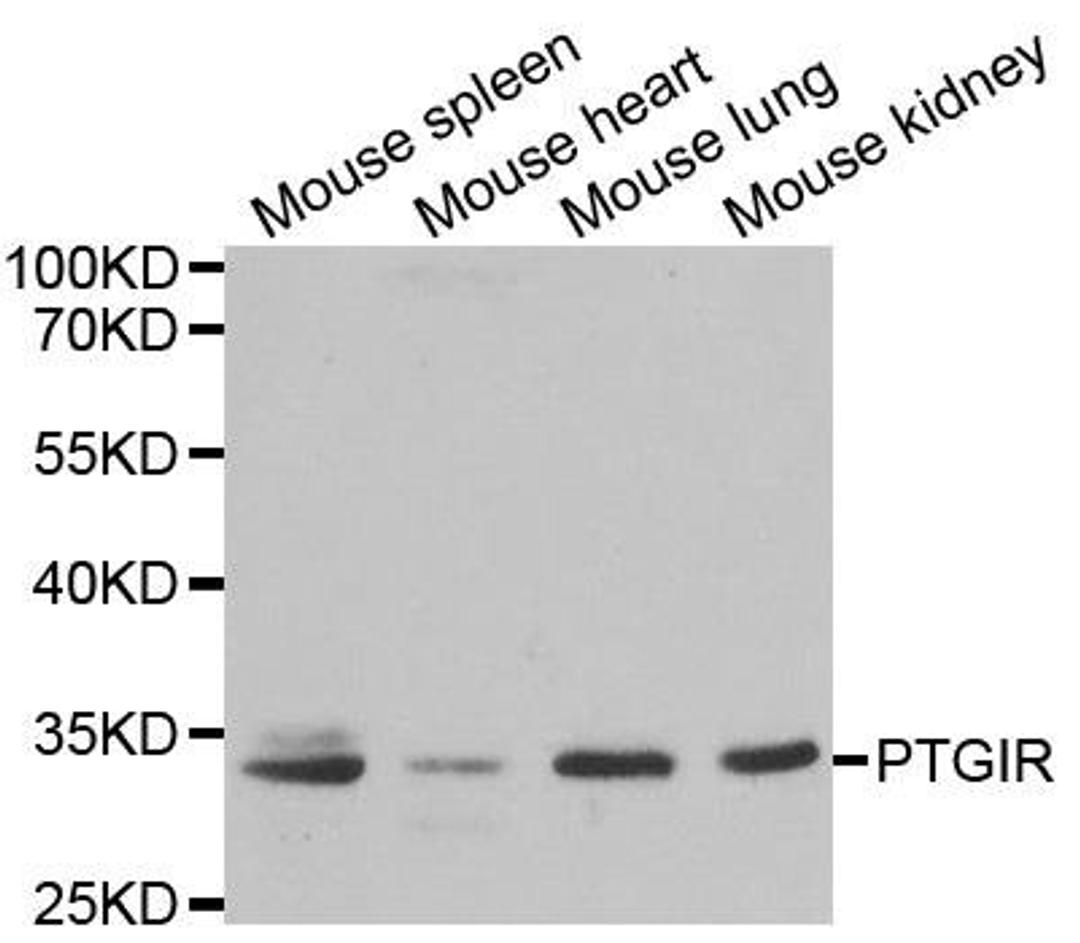 Western blot analysis of extracts of various cell lines using PTGIR antibody