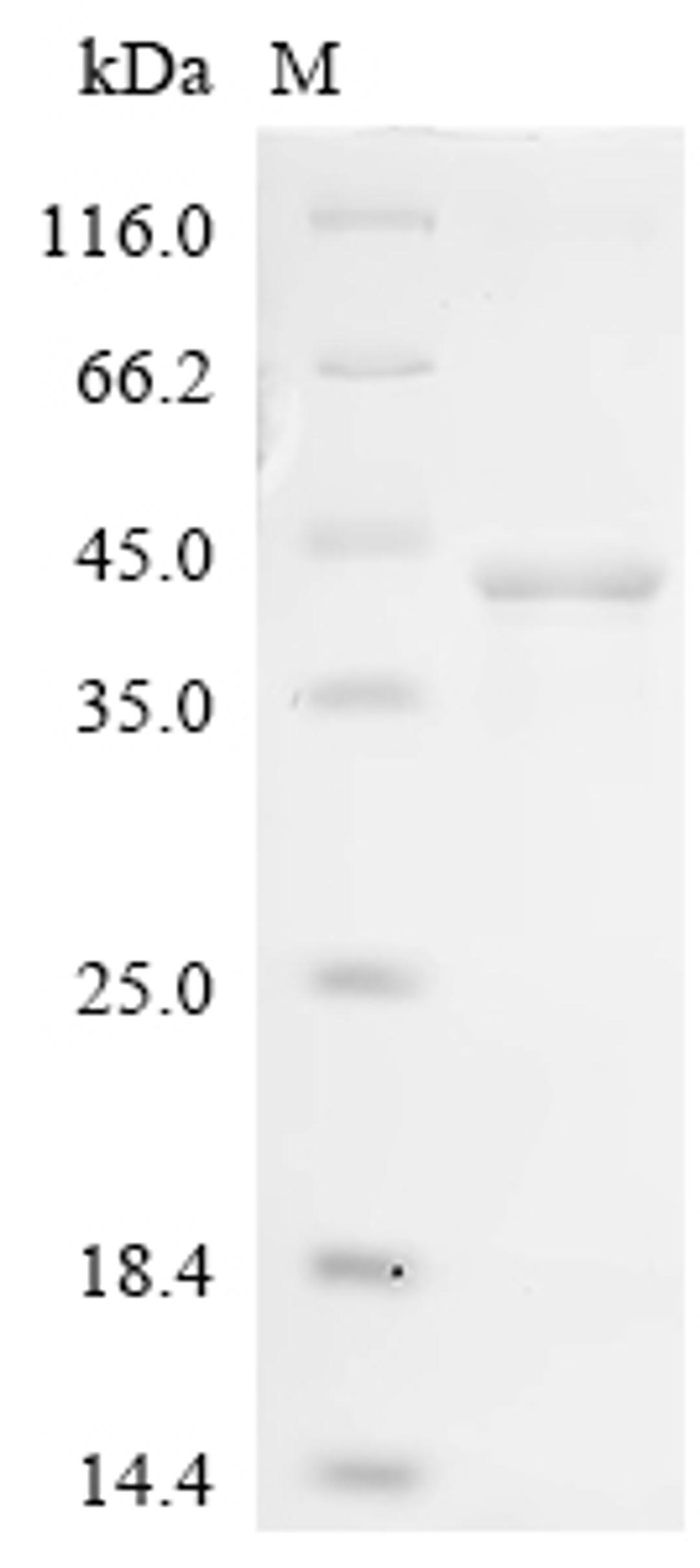 (Tris-Glycine gel) Discontinuous SDS-PAGE (reduced) with 5% enrichment gel and 15% separation gel.