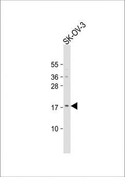 Western Blot at 1:1000 dilution + SK-OV-3 whole cell lysate Lysates/proteins at 20 ug per lane.