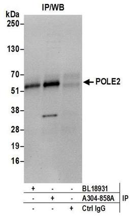 Detection of human POLE2 by WB of IP.