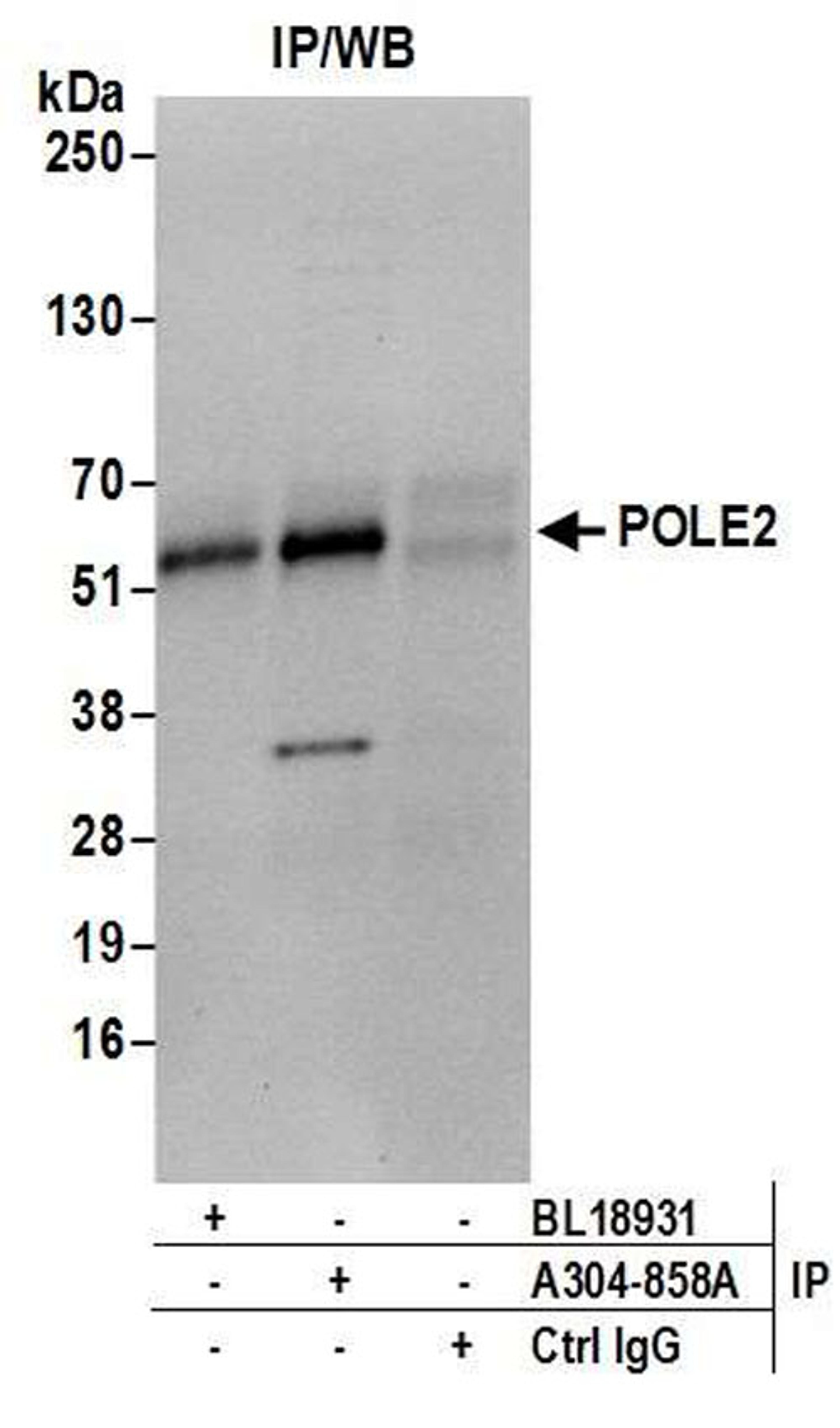 Detection of human POLE2 by WB of IP.