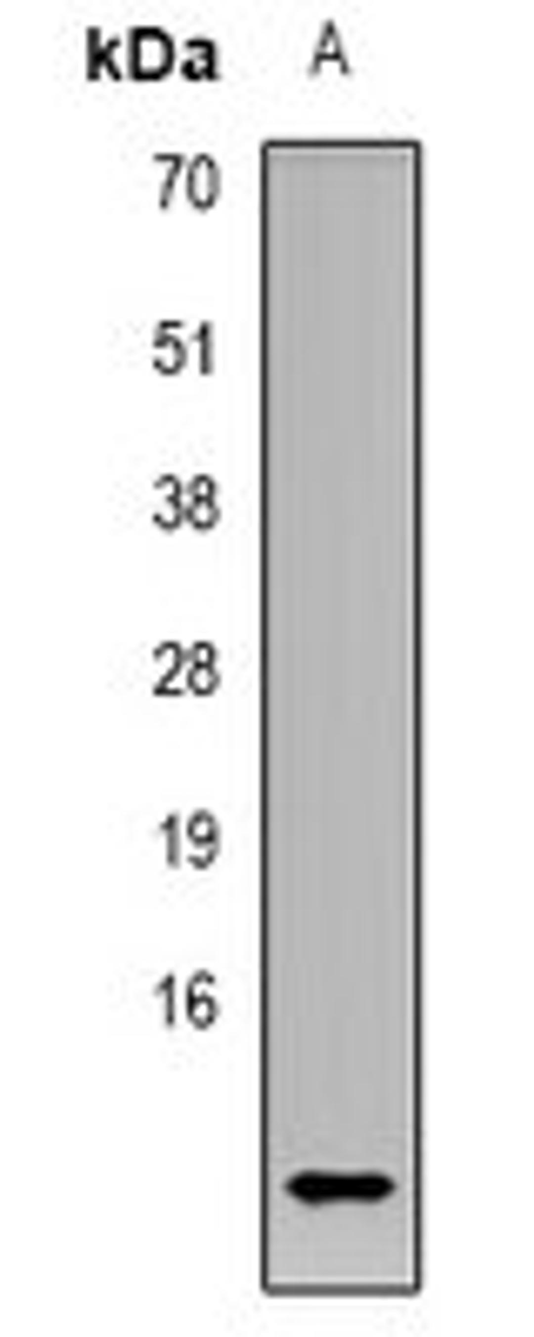 Western blot analysis of K562 (Lane 1) whole cell lysates using CCL4L1 antibody