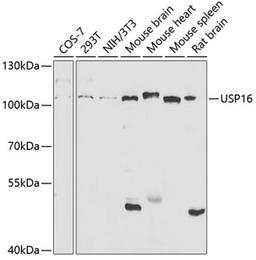 Western blot - USP16 antibody (A5861)