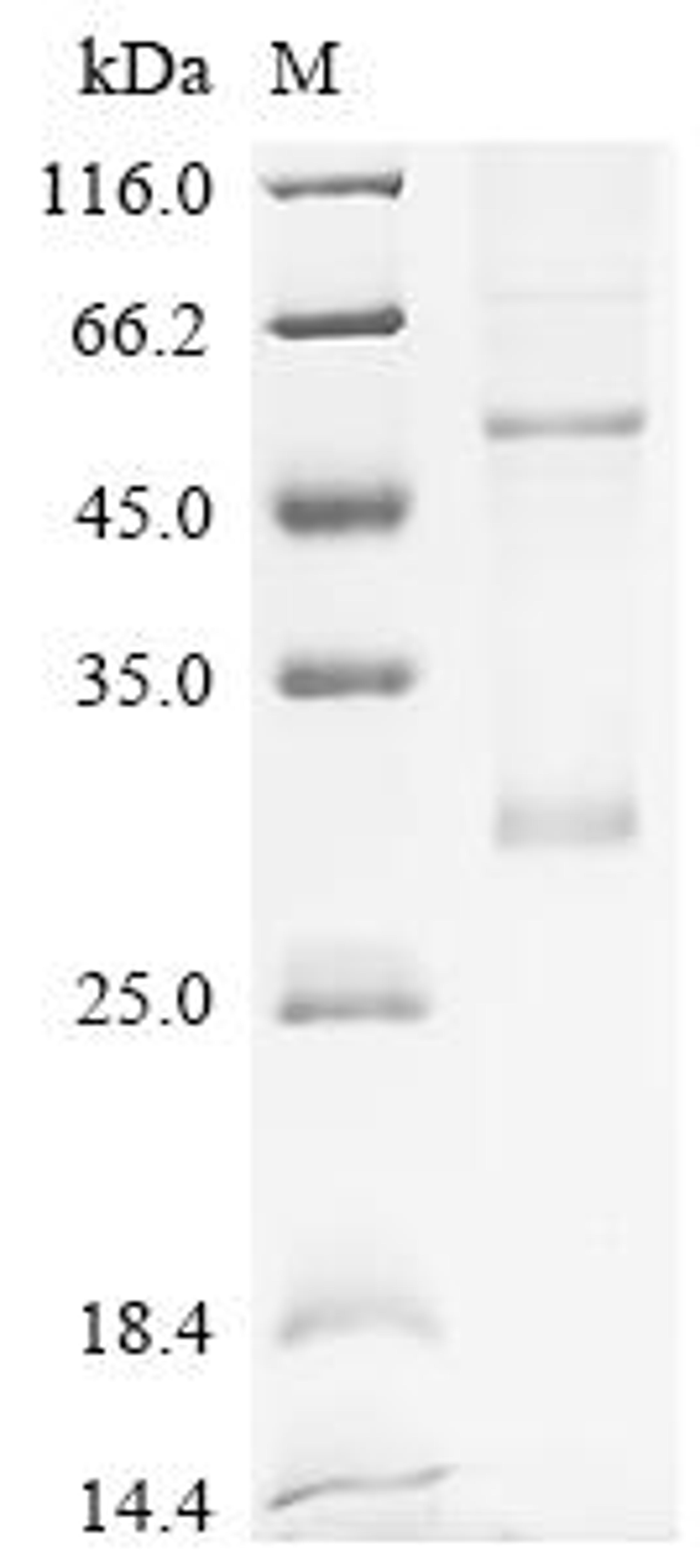 (Tris-Glycine gel) Discontinuous SDS-PAGE (reduced) with 5% enrichment gel and 15% separation gel.
