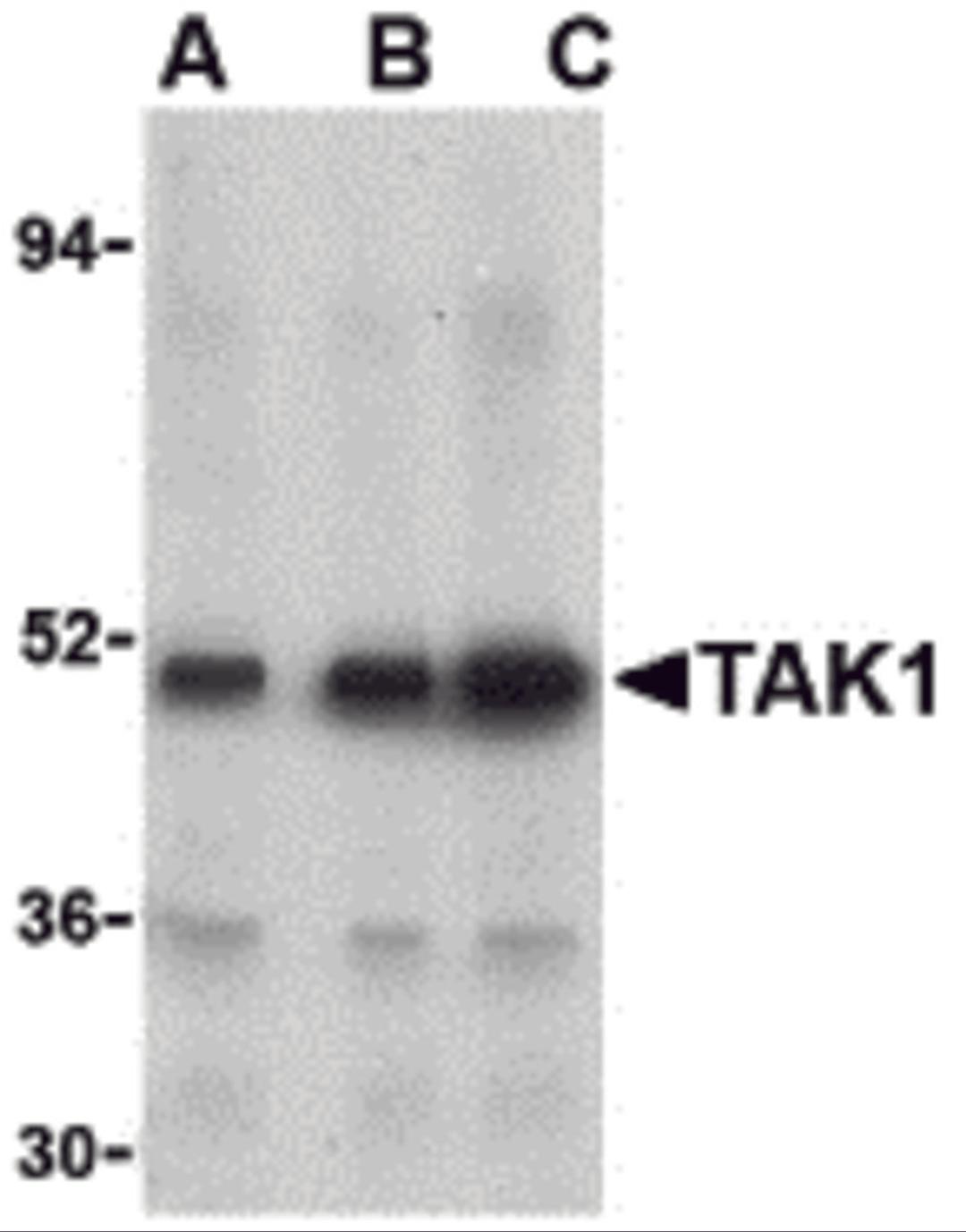 Western blot analysis of TAK1 in Rat thymus cell lysate with TAK1 antibody at (A) 1, (B) 2, and (C) 4 &#956;g/mL. 