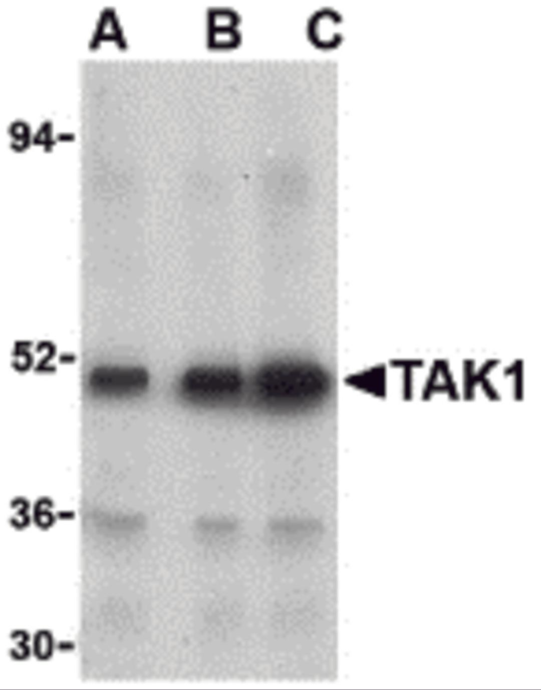 Western blot analysis of TAK1 in Rat thymus cell lysate with TAK1 antibody at (A) 1, (B) 2, and (C) 4 μg/mL.